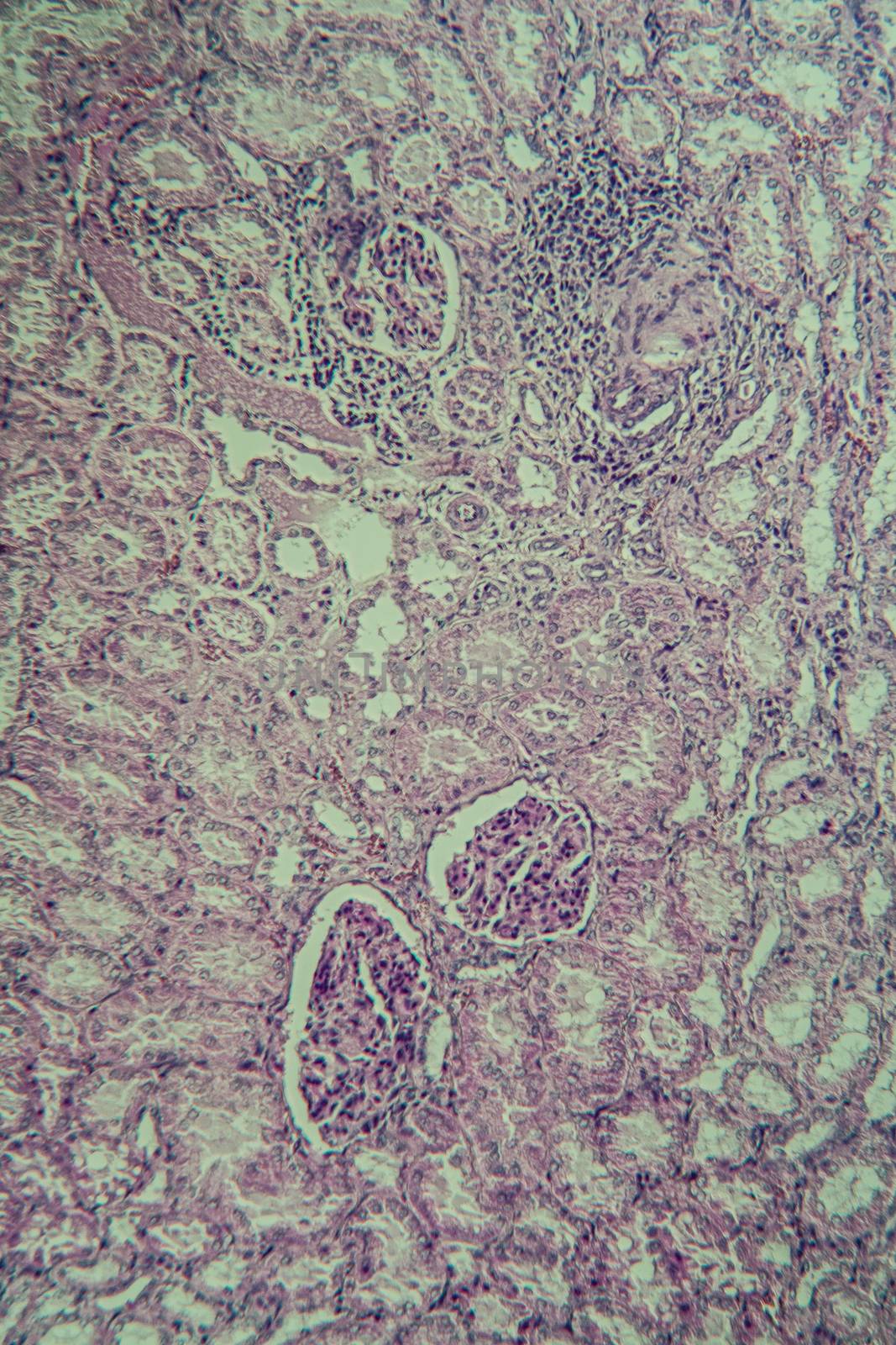 Cross section of the kidney with Glumeroli 100x
