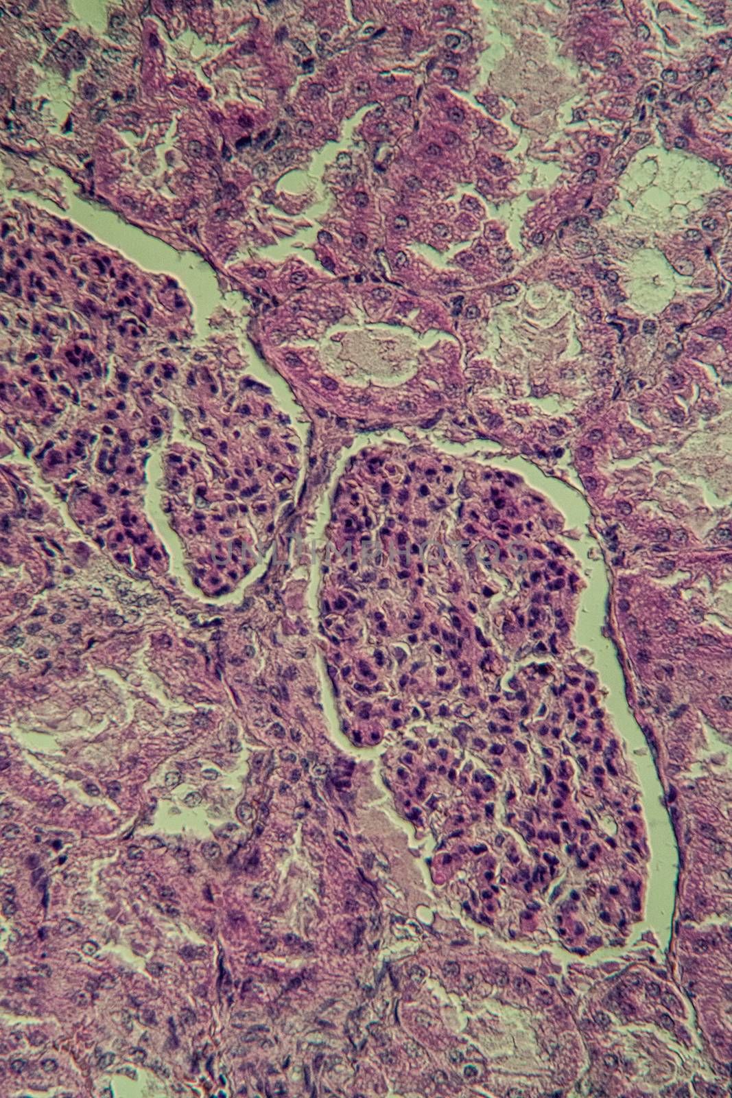 Cross section of the kidney with Glumeroli 200x by Dr-Lange