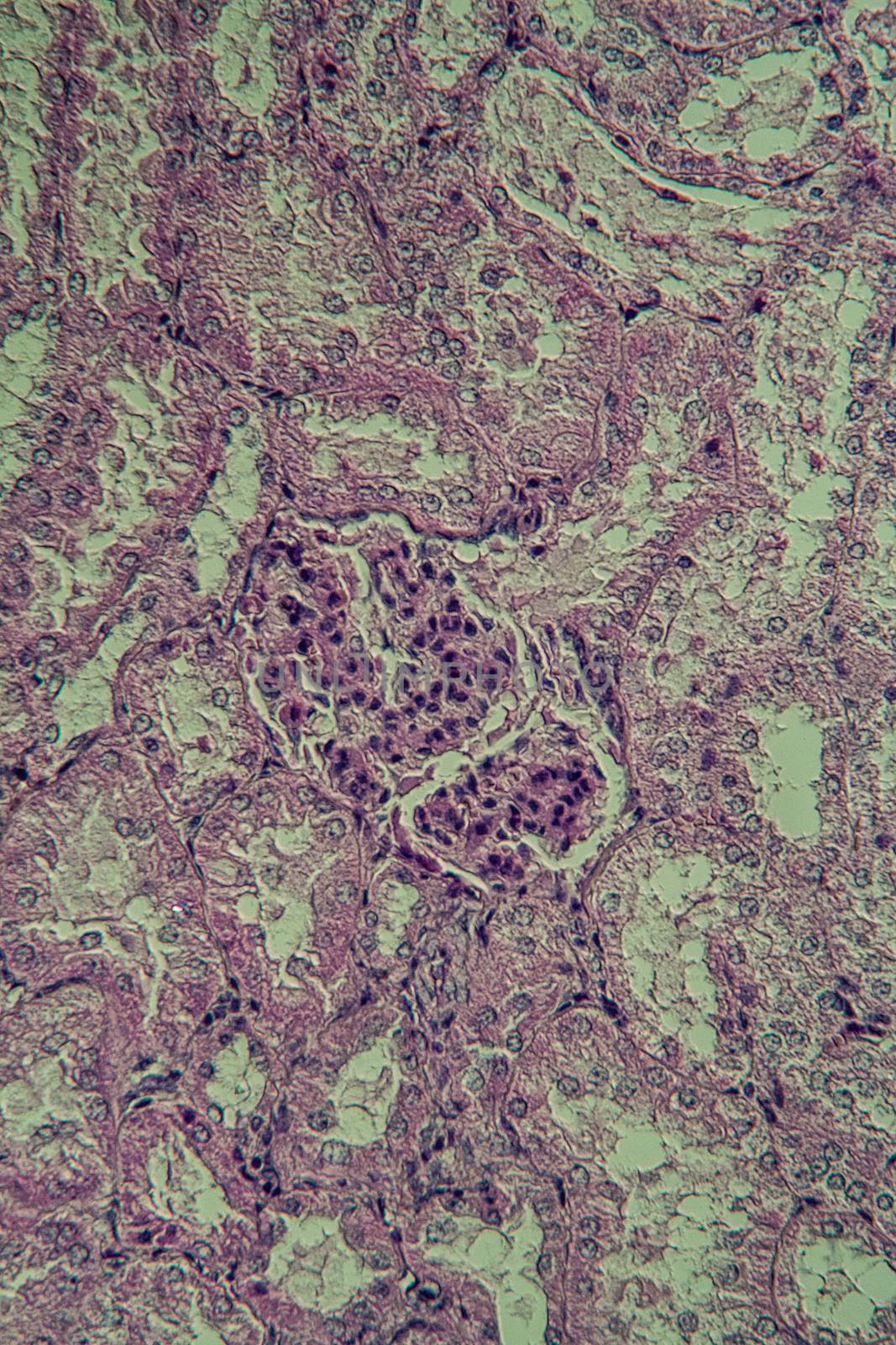 Cross section of the kidney with Glumeroli 200x