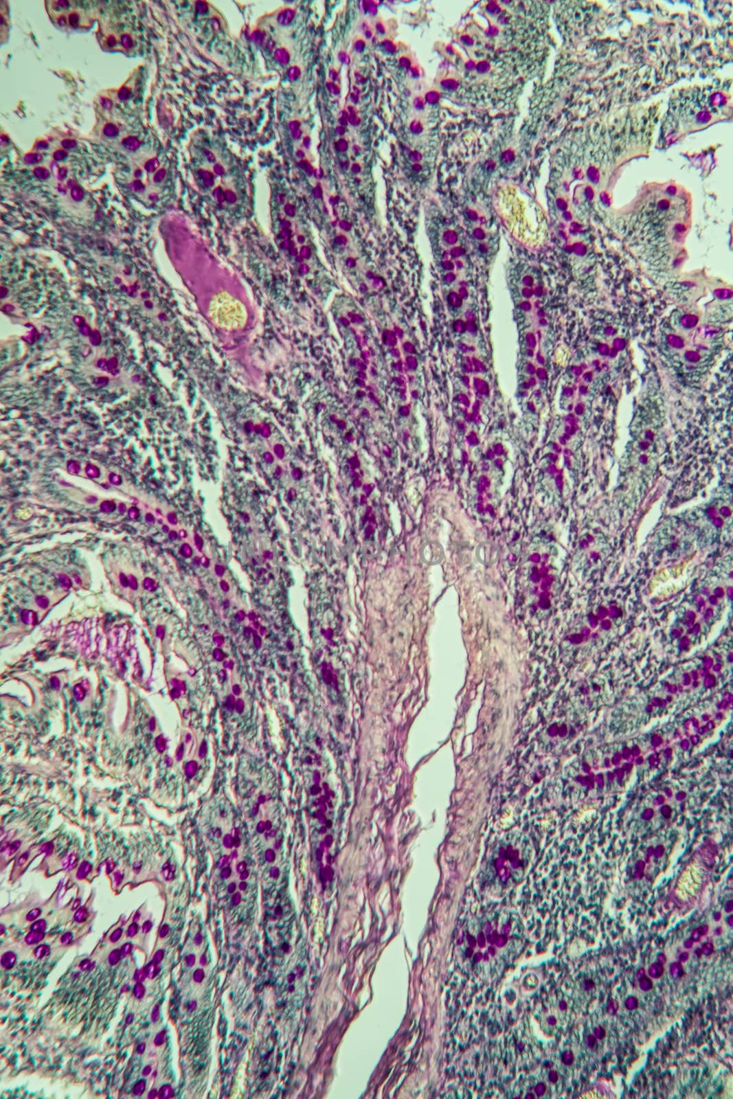 Small intestine pig tissue across 100x by Dr-Lange