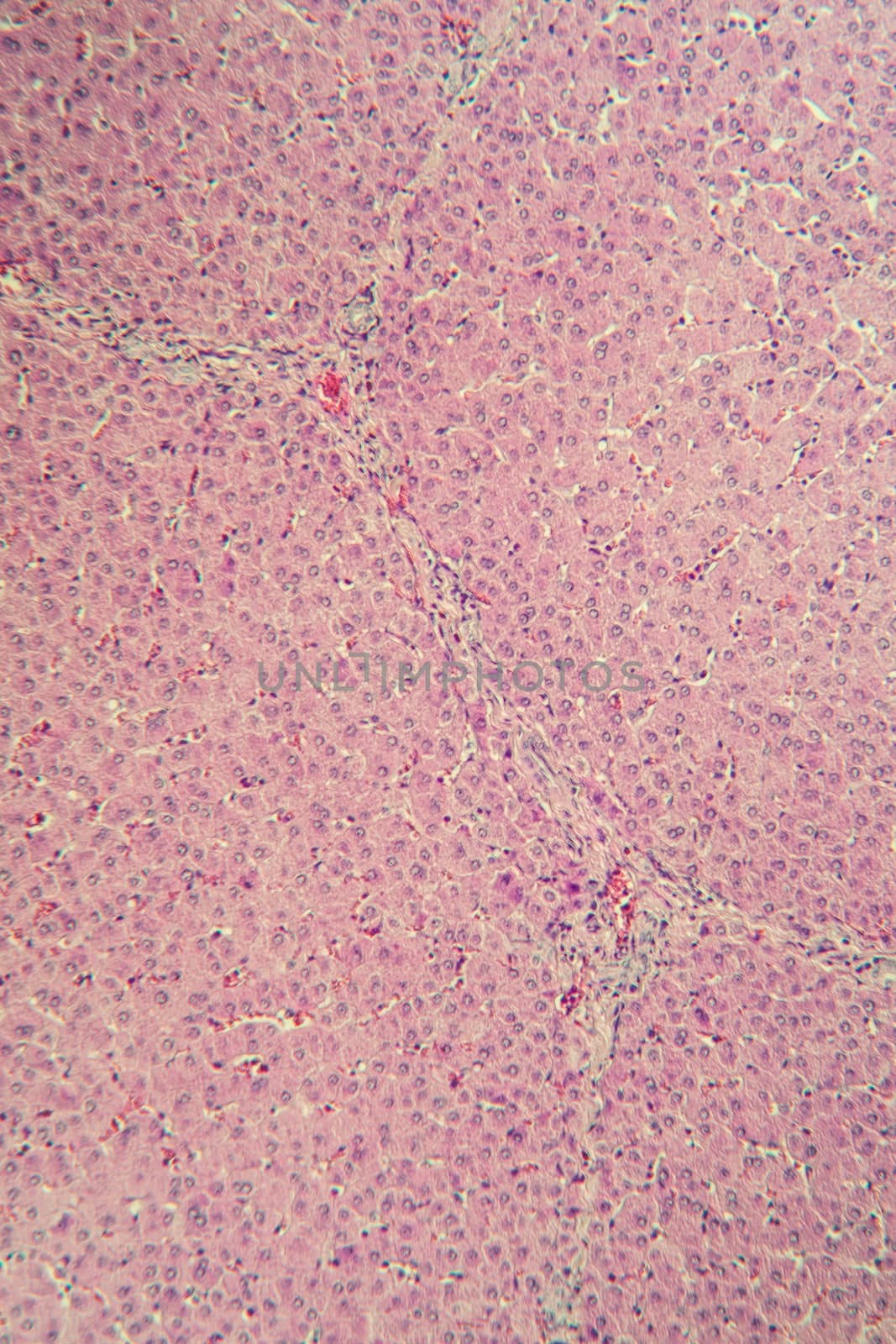 Pork liver tissue cut 100x by Dr-Lange