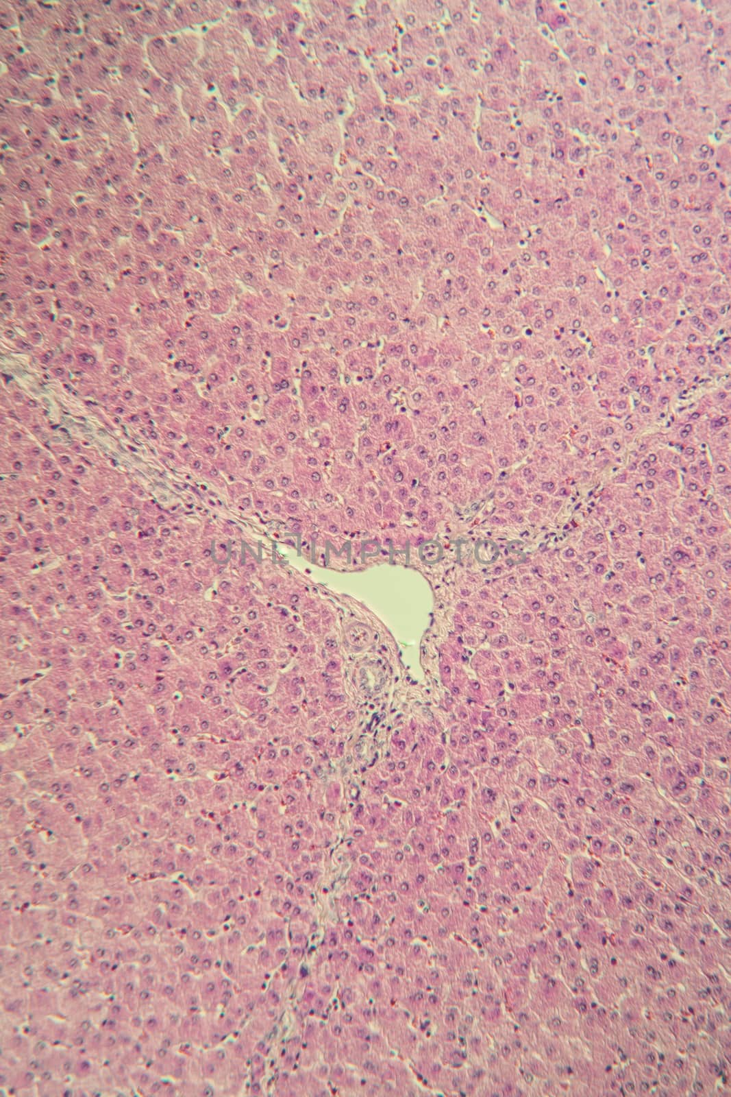 Pork liver tissue cut 100x