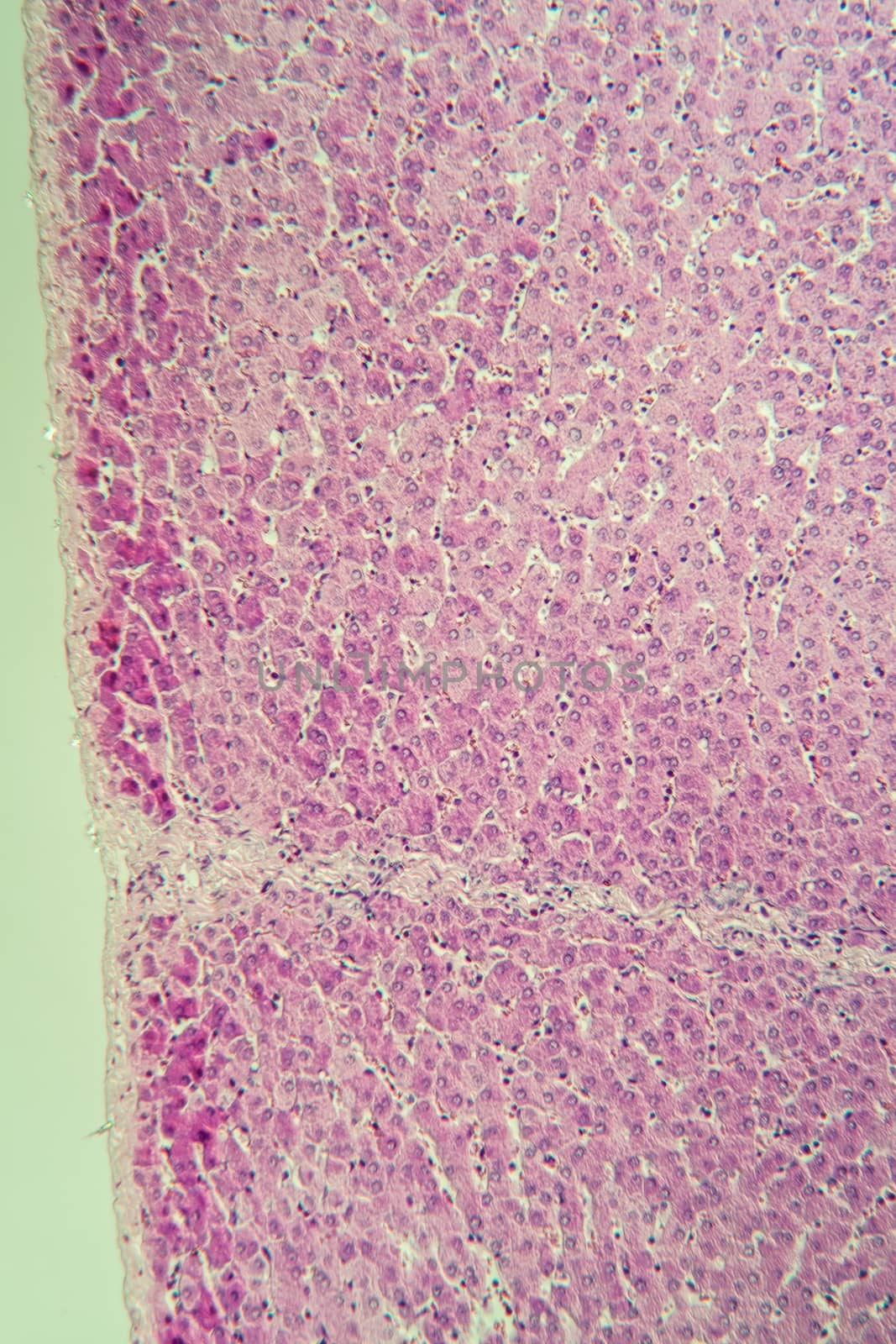 Pork liver tissue cut 100x