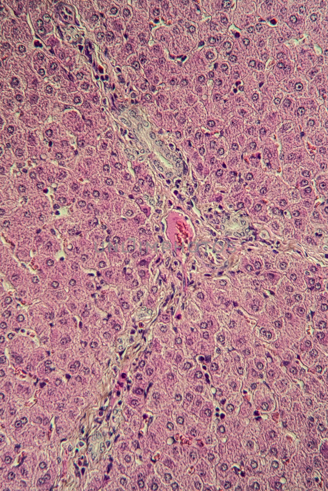 Pork liver tissue cut 100x by Dr-Lange