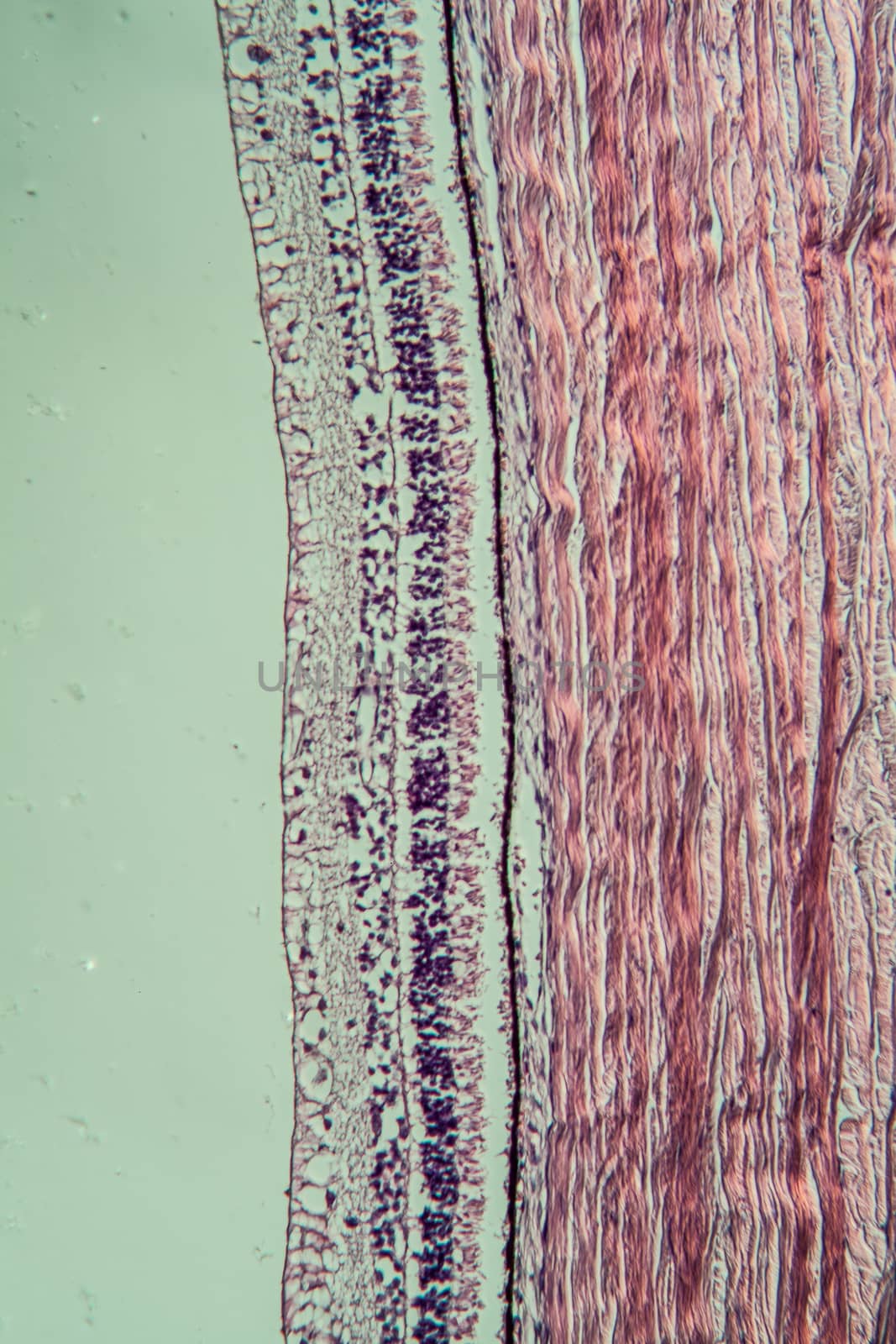 Cross-section through the retina 100x by Dr-Lange