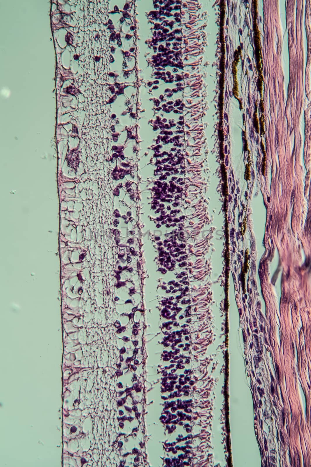 Cross-section through the retina 100x by Dr-Lange