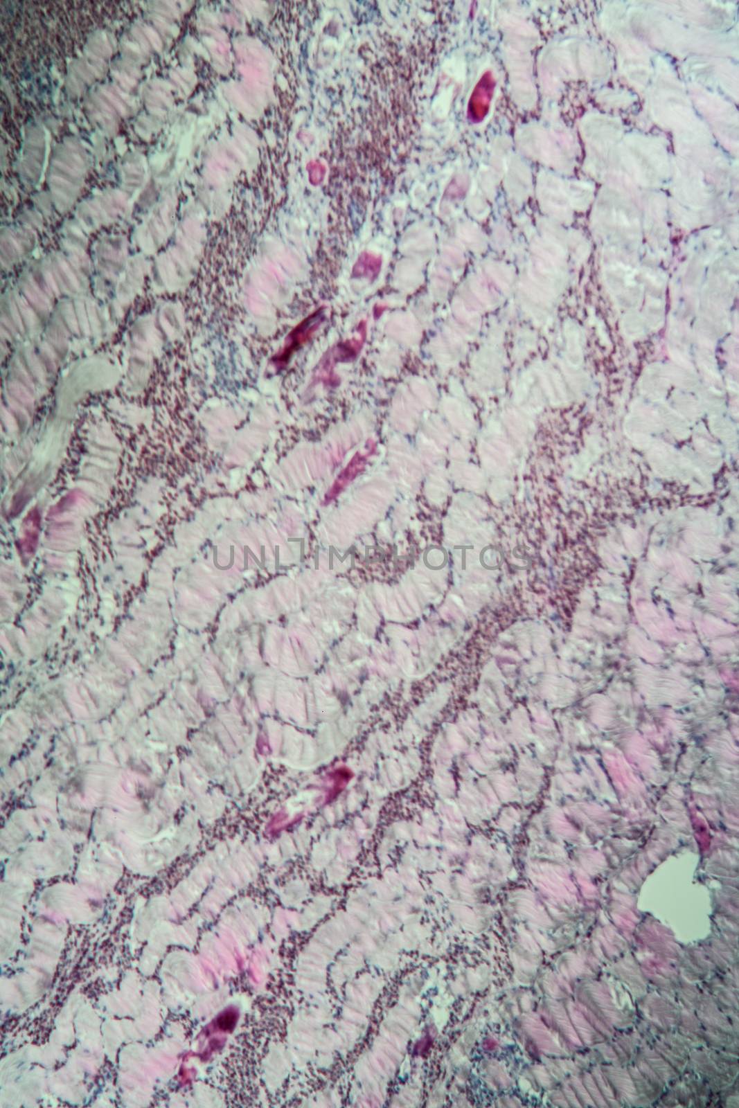 Sarcocystis spore animals in muscle, 100x