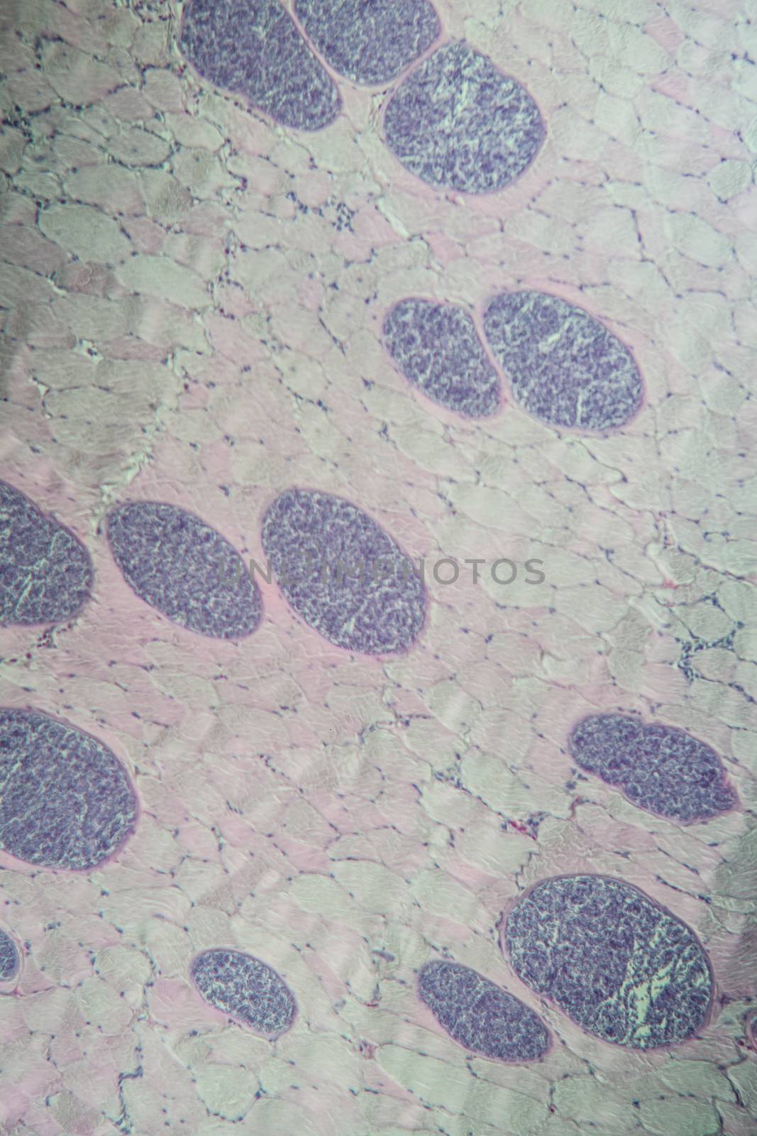 Sarcocystis spore animals in muscle, 100x