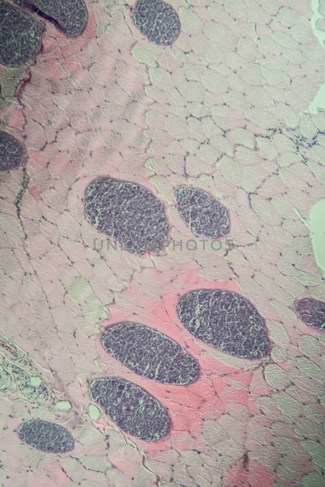 Sarcocystis spore animals in muscle, 100x