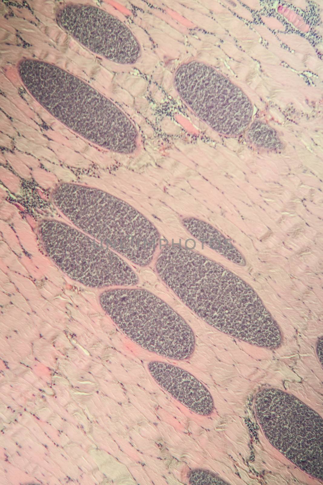 Sarcocystis spore animals in muscle, 100x