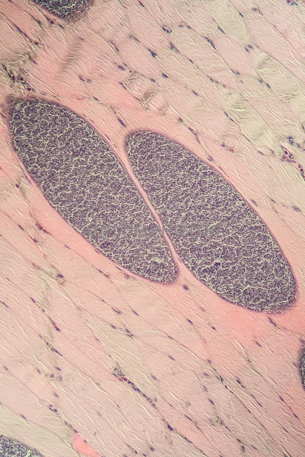 Sarcocystis spore animals in muscle, 200x by Dr-Lange