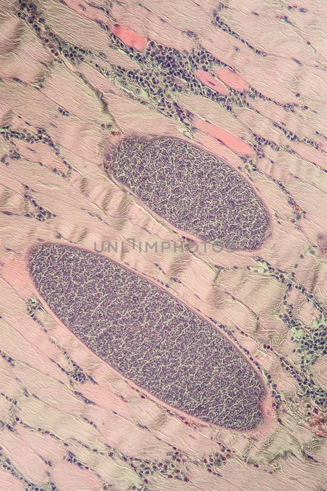 Sarcocystis spore animals in muscle, 200x