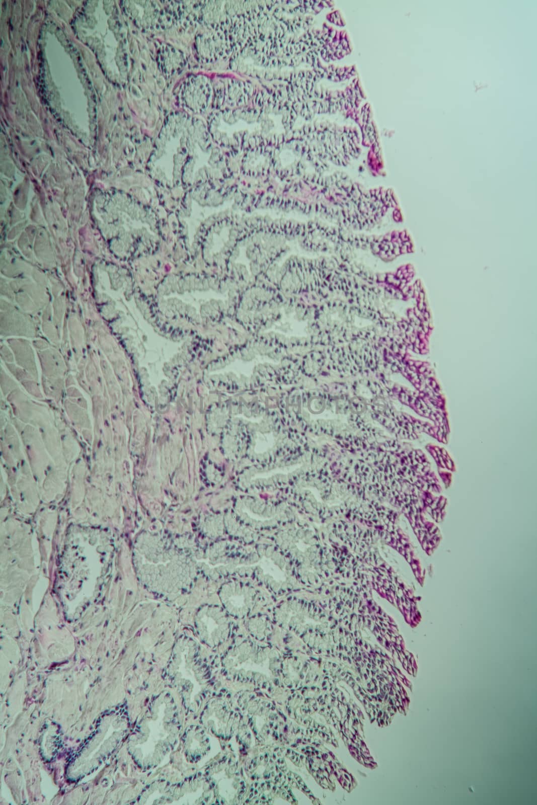 Toad cross section through the tongue 200x