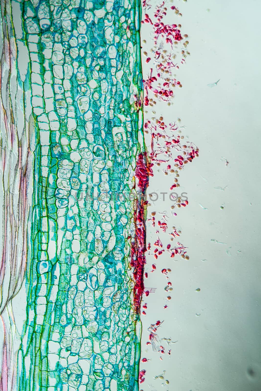 downy mildew on pastoral herb 100x by Dr-Lange