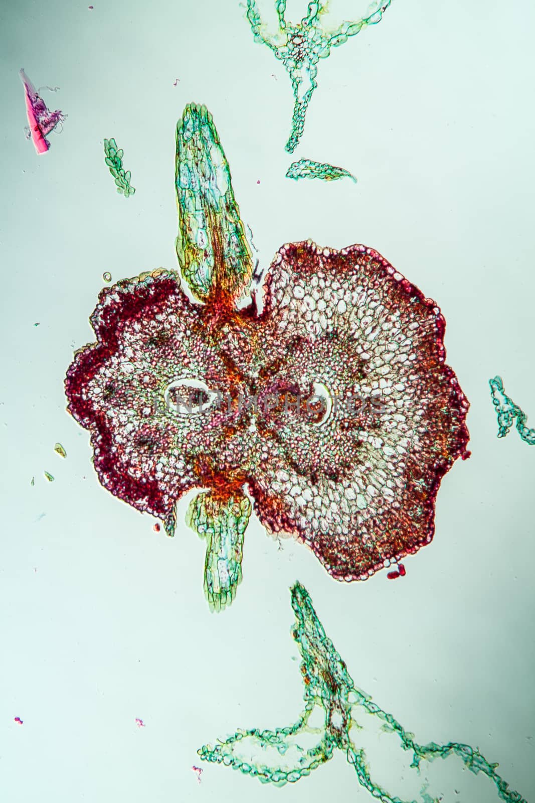 Yarrow flowers under the microscope across 100x by Dr-Lange