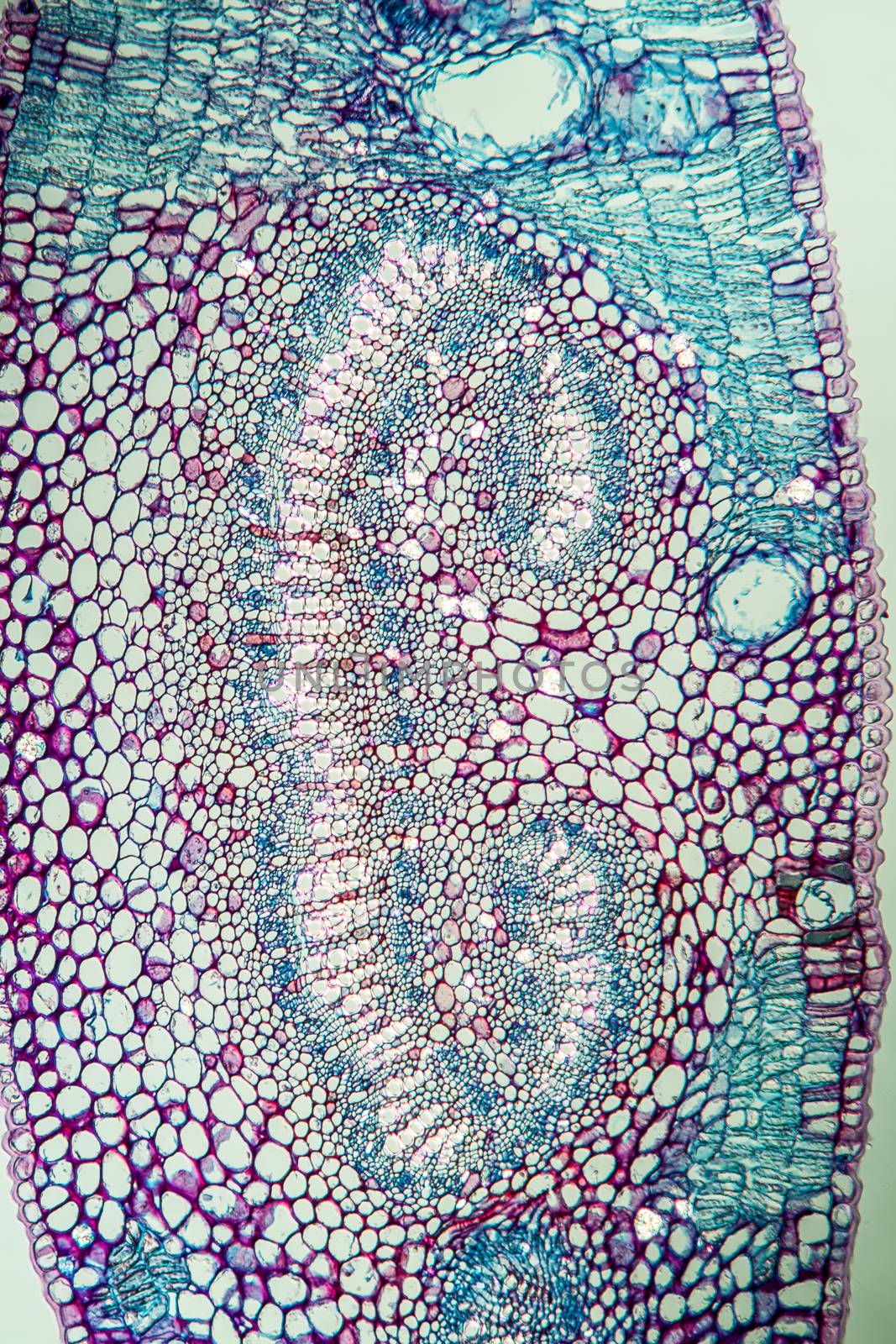 Eucalyptus cross section through leaf 100x by Dr-Lange