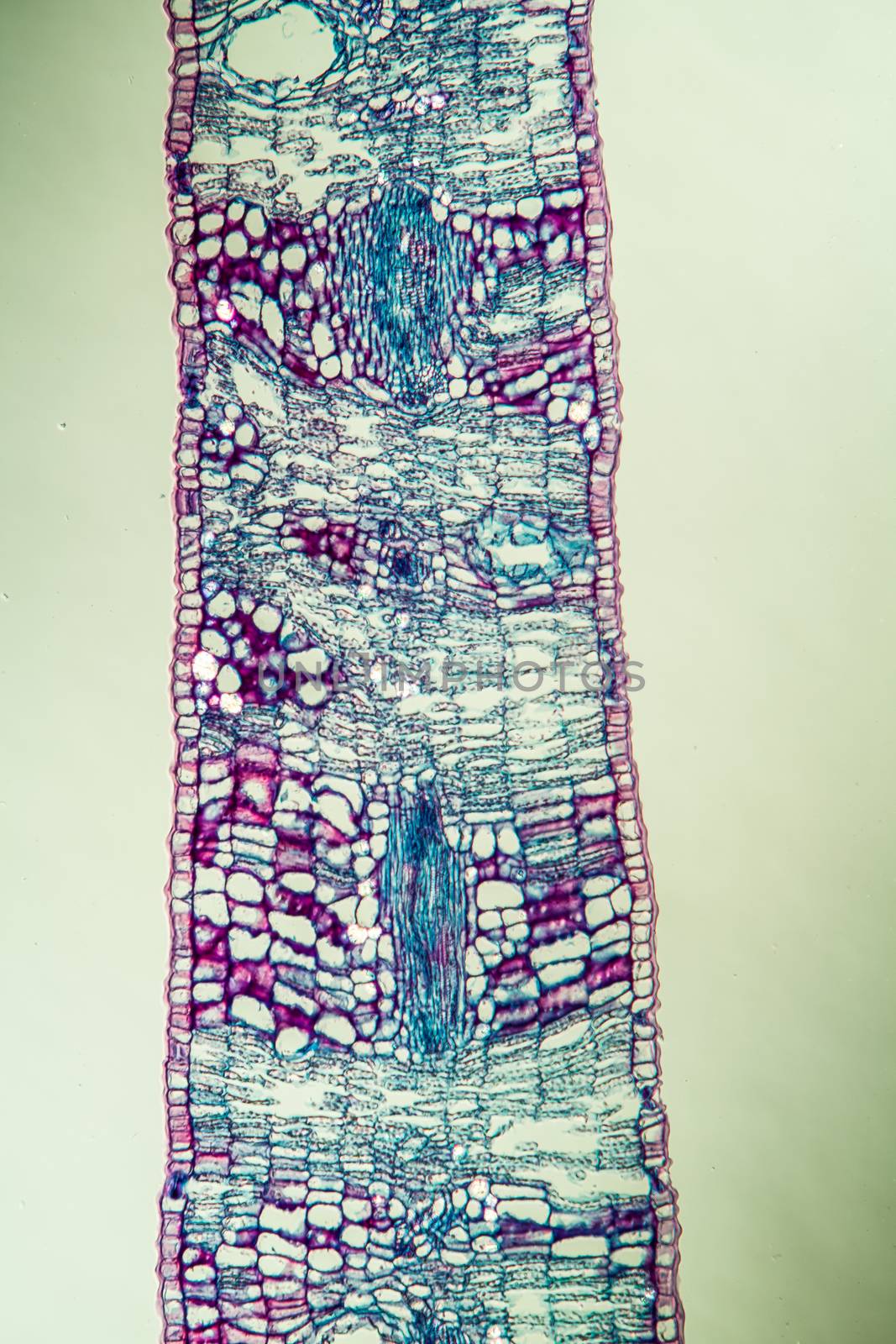 Eucalyptus cross section through leaf 100x by Dr-Lange
