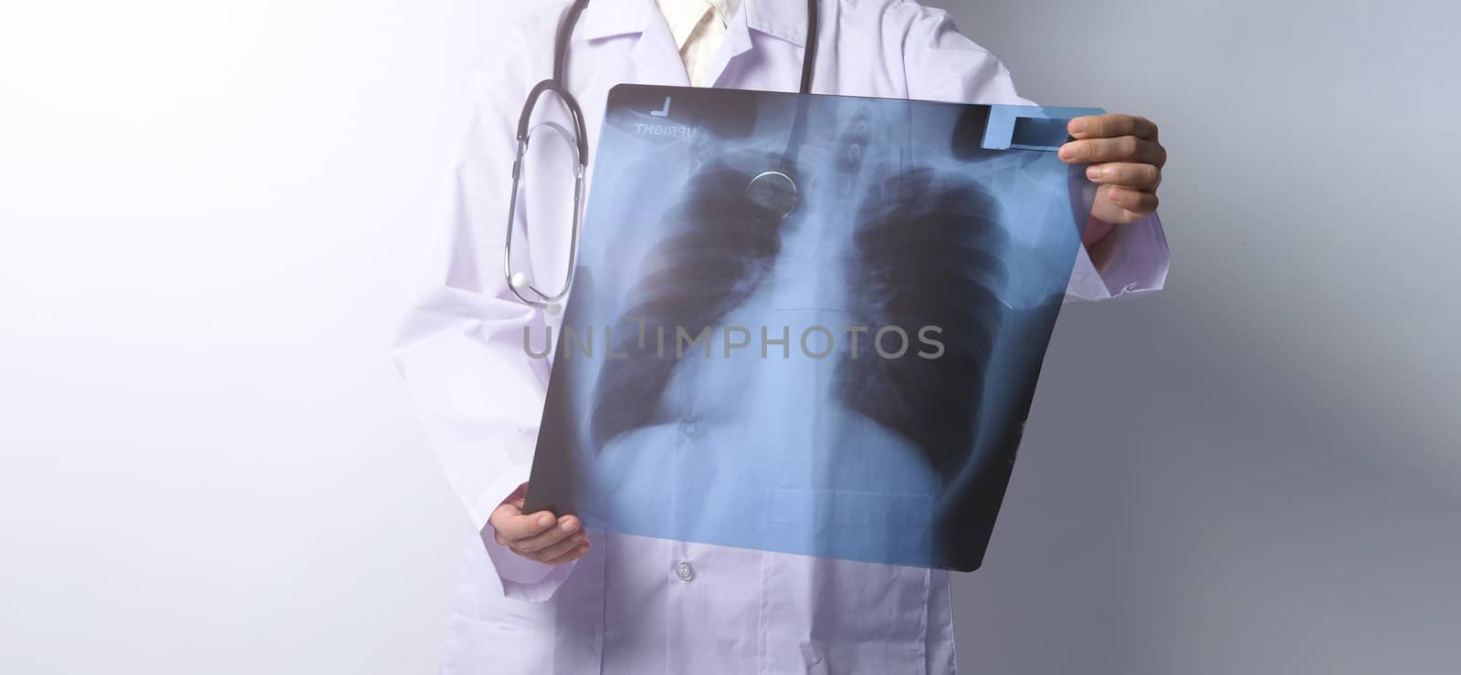 Asia woman doctor holding and checking up lung’s x-ray film or radiograph from coronavirus pandemic. doctor wearing hospital uniform and stethoscope on neck. studio shot and white background.