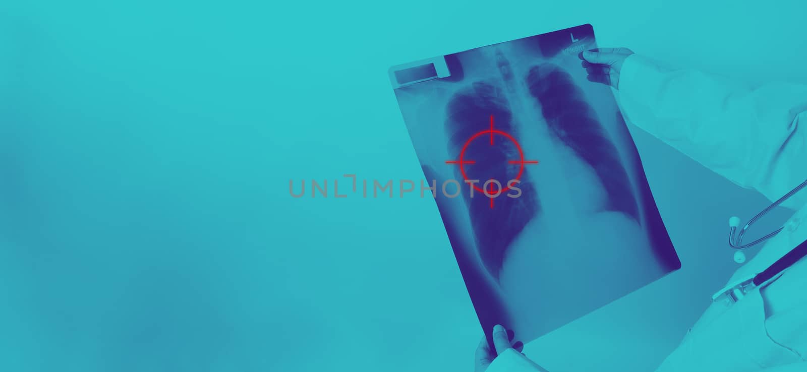 Asia woman doctor holding and checking up lung’s x-ray film  by gnepphoto