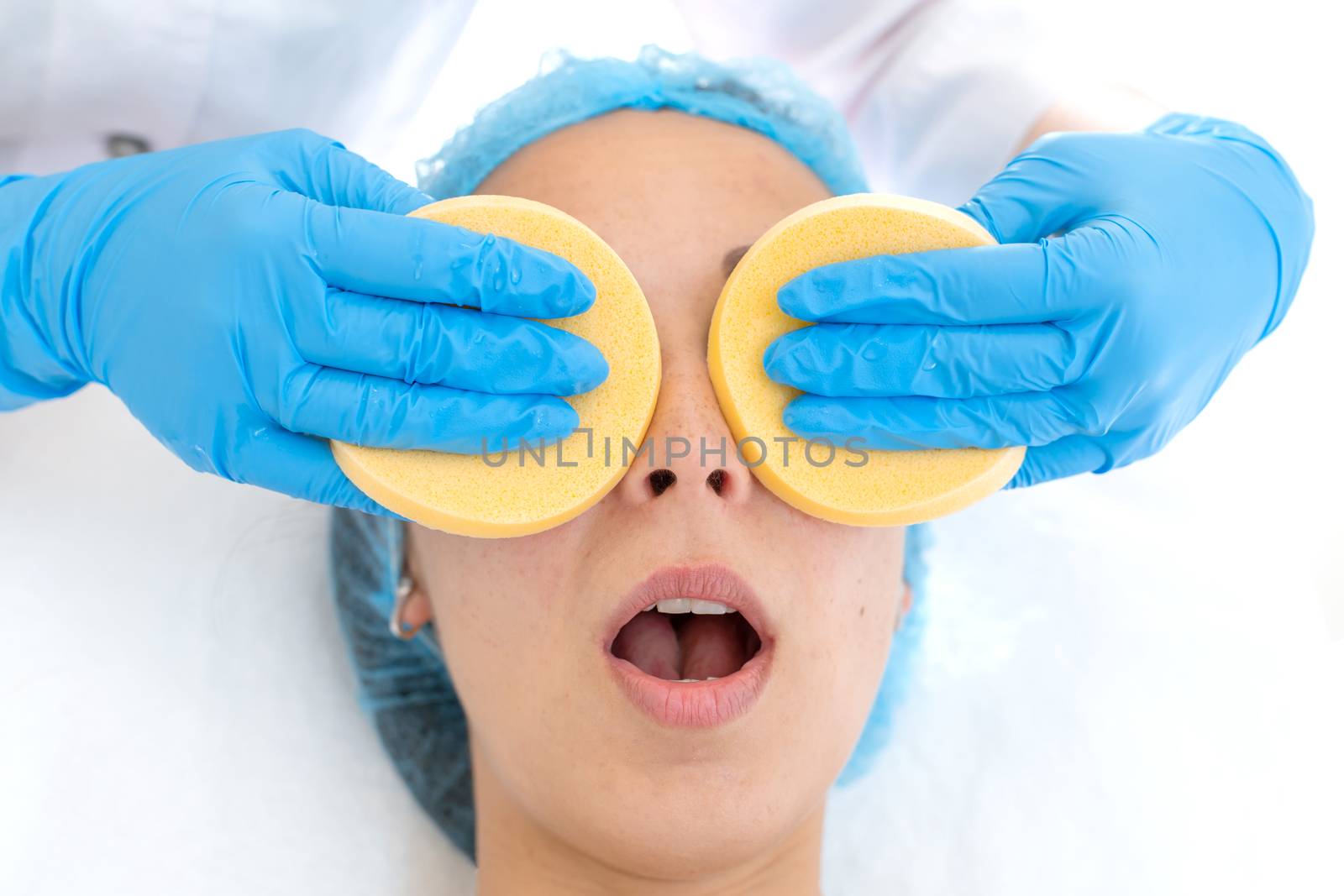 A woman, a professional doctor, a beautician cleanses the patient's face with sponges before applying the mask for skin care.
