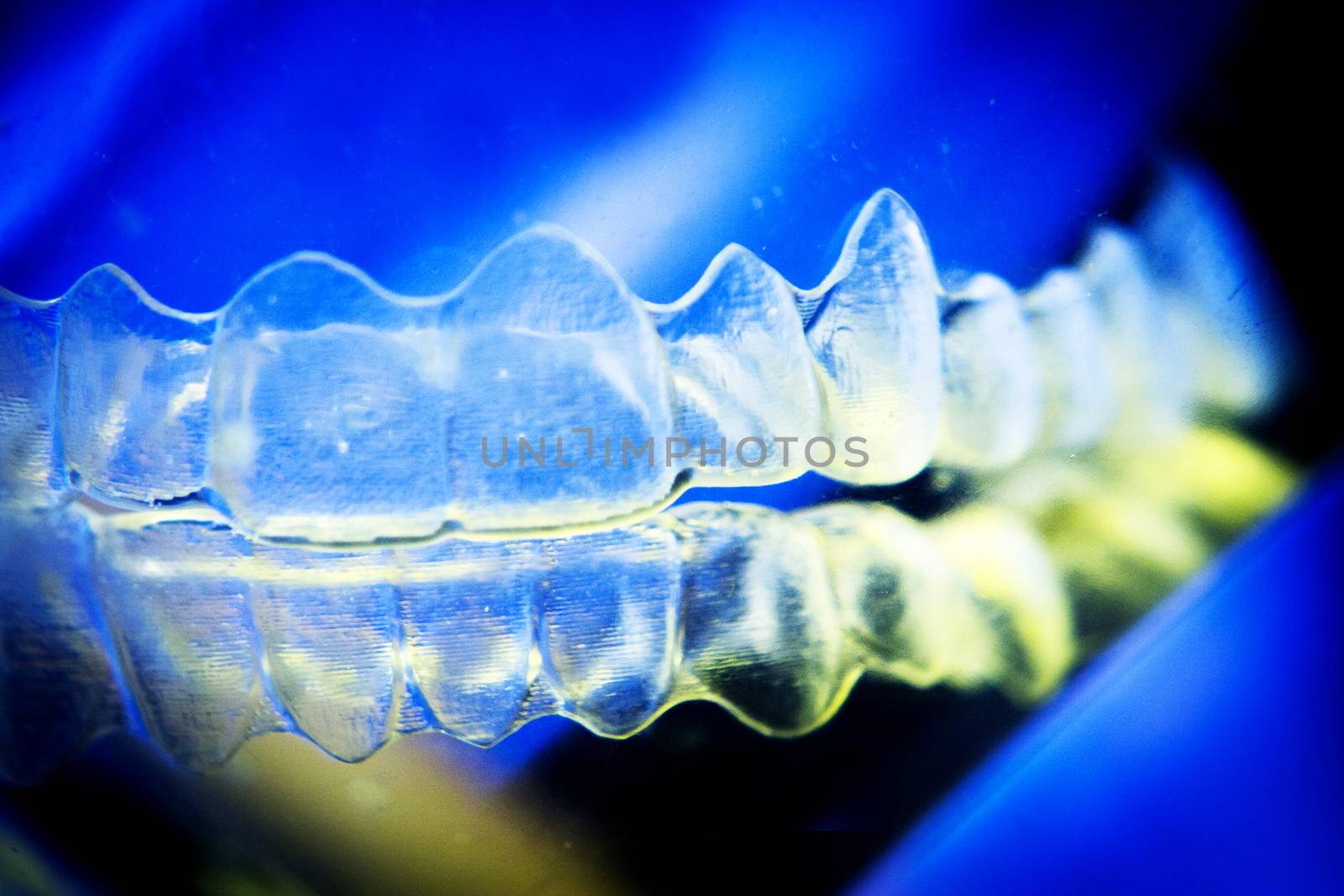 Invisible dental orthodontics lined up cleaning by GemaIbarra