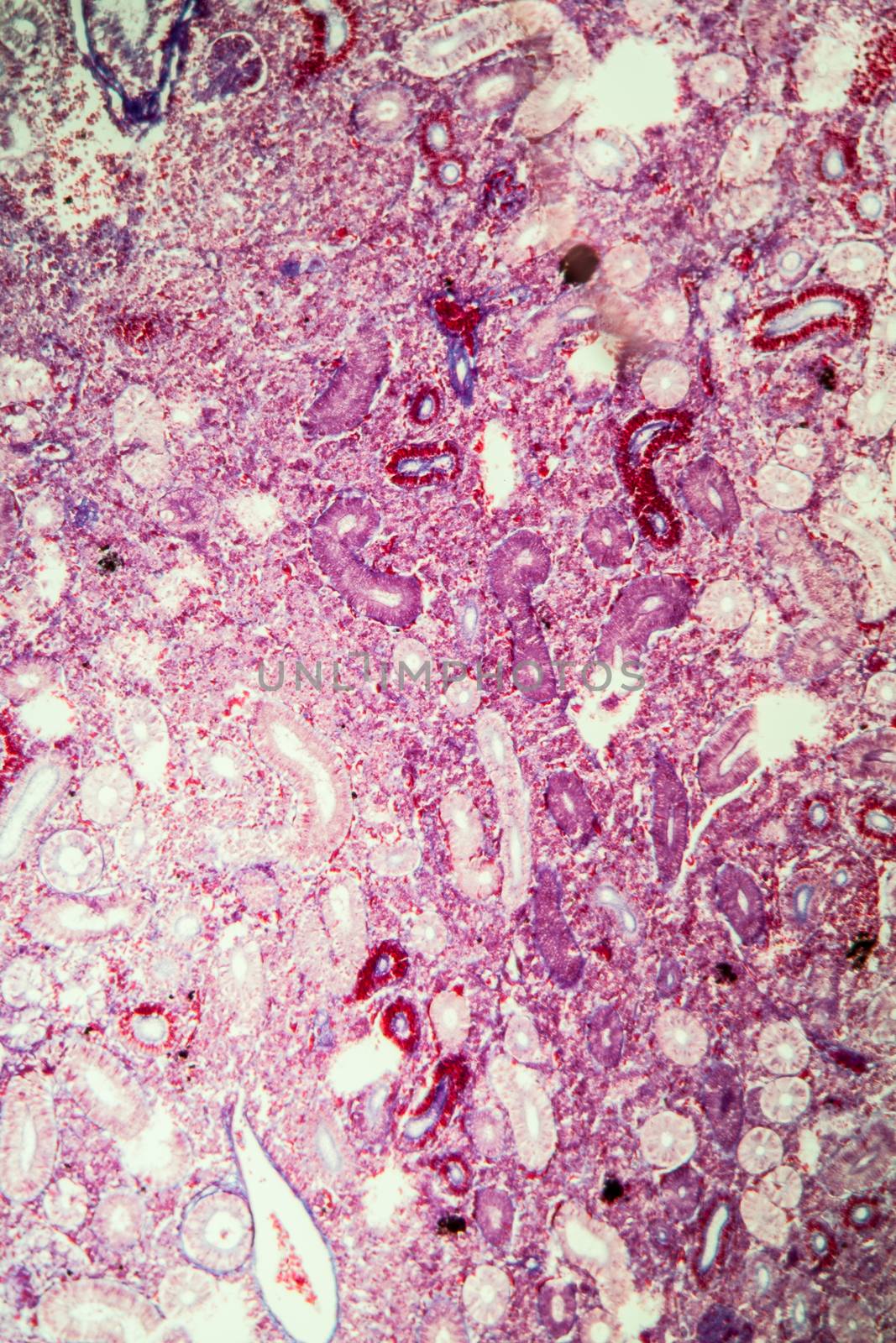 Pike kidney in cross section 100x