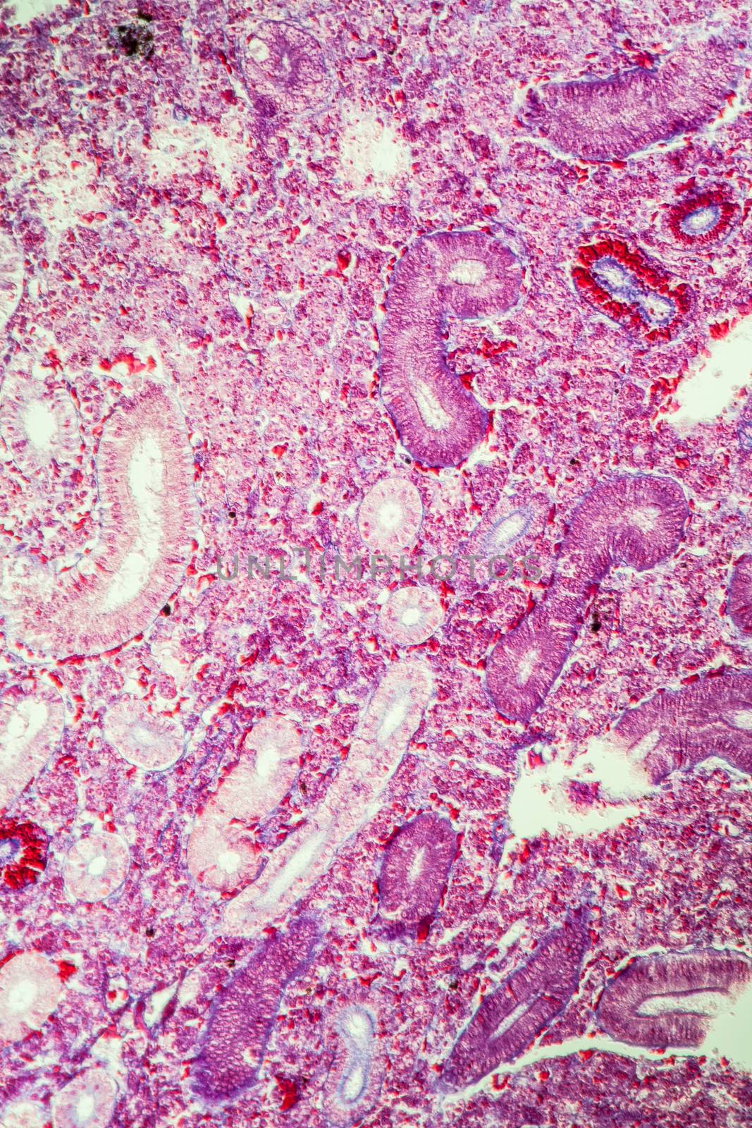 Pike kidney in cross section 100x by Dr-Lange