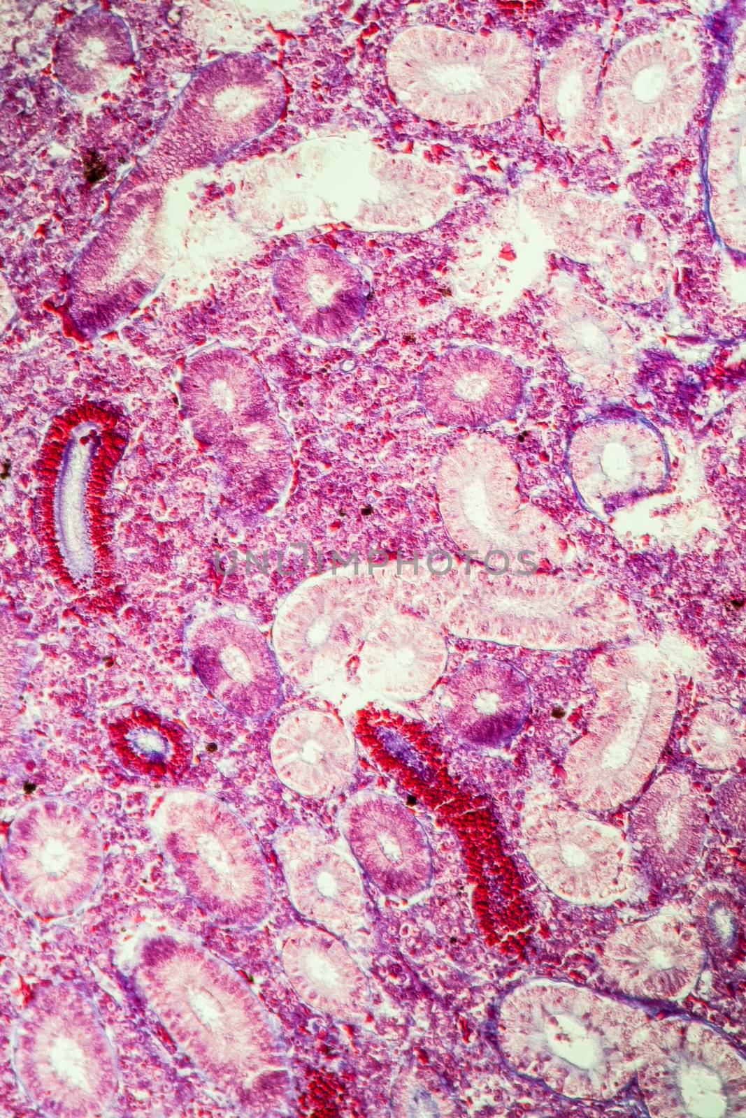 Pike kidney in cross section 100x