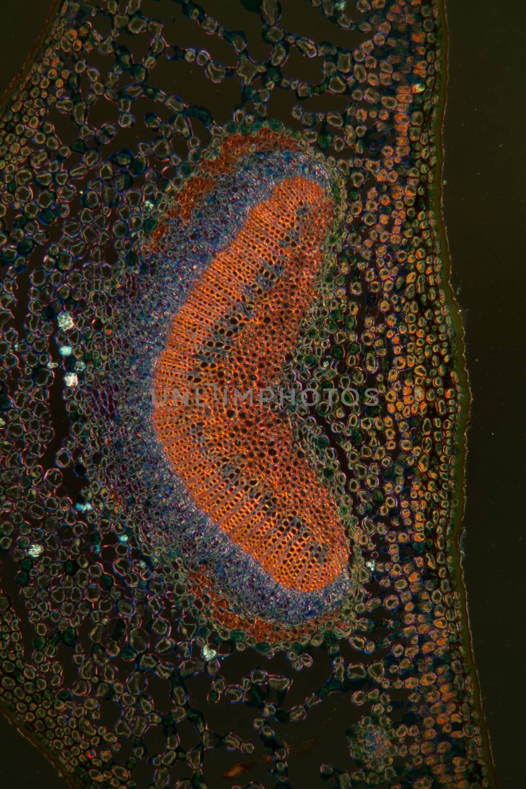 Holly palm leaf under the microscope 100x by Dr-Lange