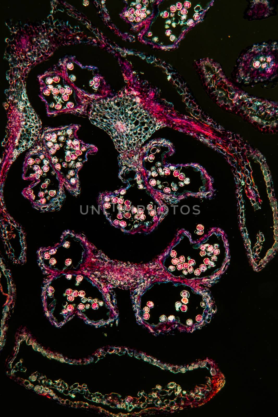 Alder cat fruit stand under the microscope 100x by Dr-Lange