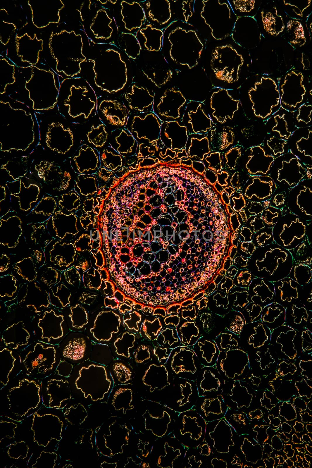 Bracken stems in cross section 100x