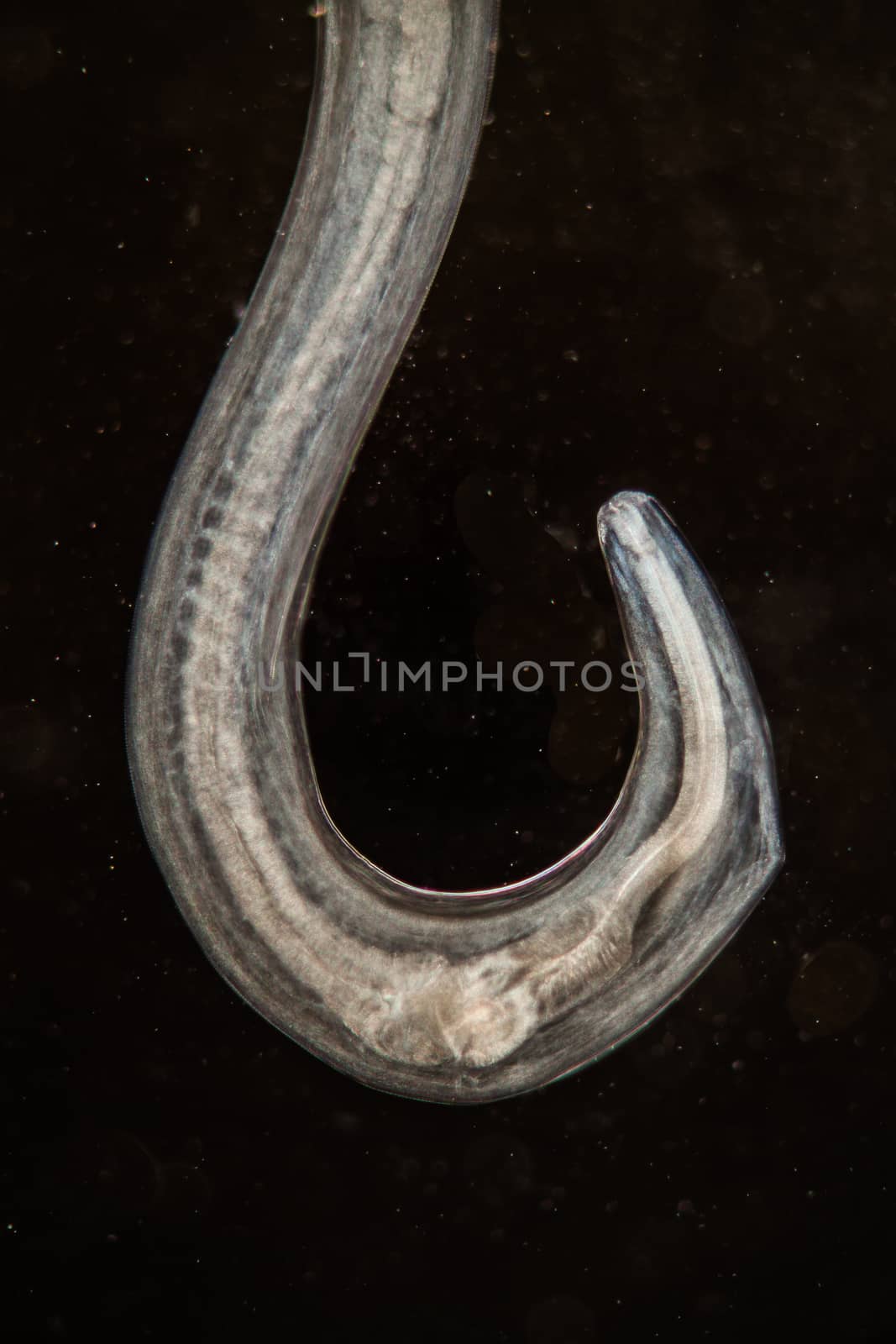 parasitic worm under the microscope 100x by Dr-Lange