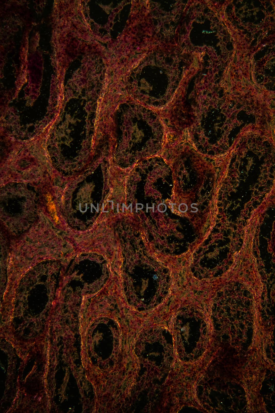 Inguinal testicle tissue under the microscope 100x by Dr-Lange