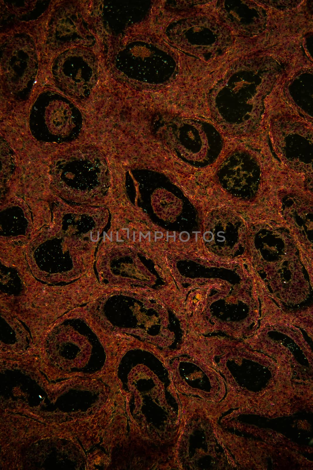 Inguinal testicle tissue under the microscope 100x by Dr-Lange