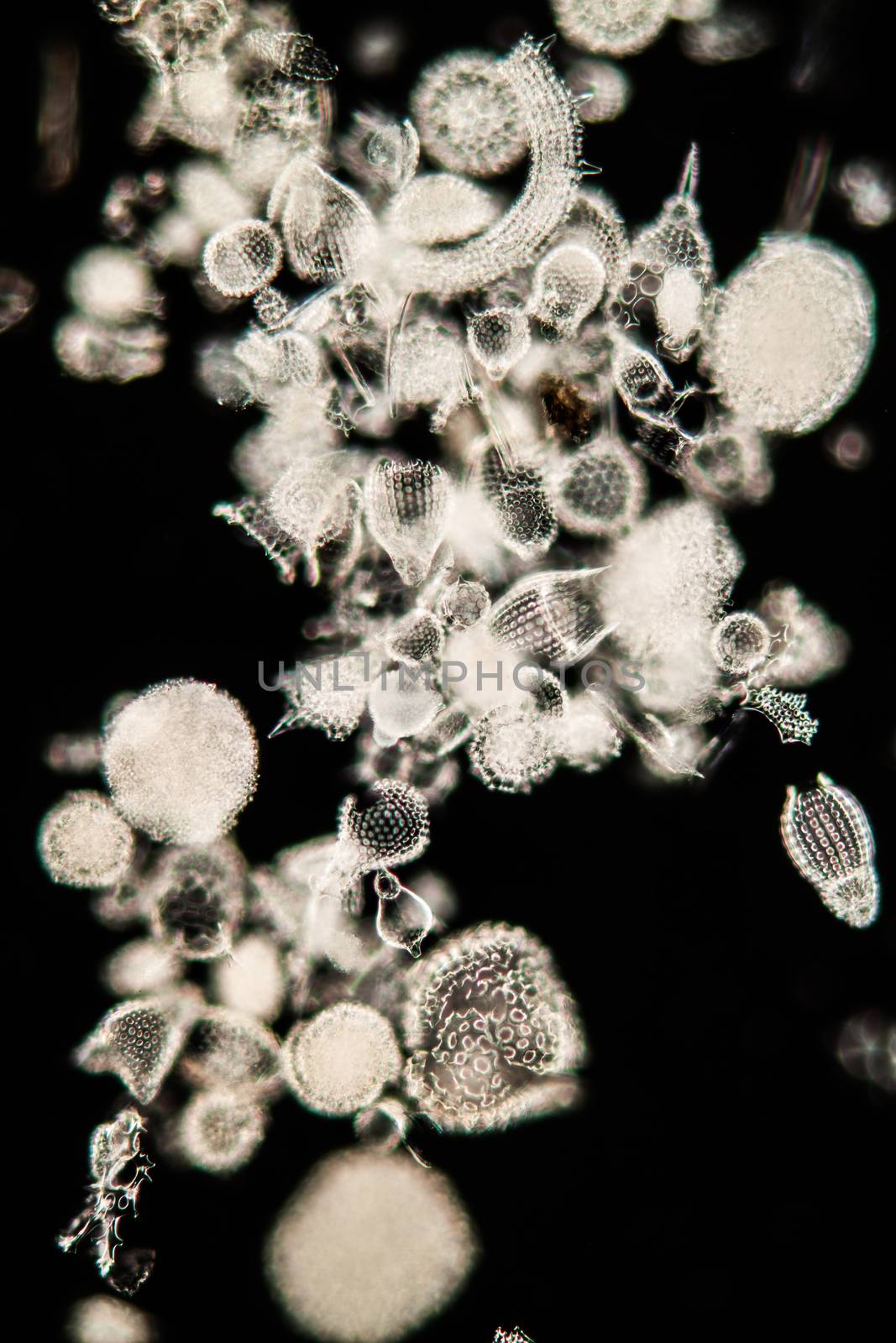 Radiolaria marine animals under the microscope 100x by Dr-Lange