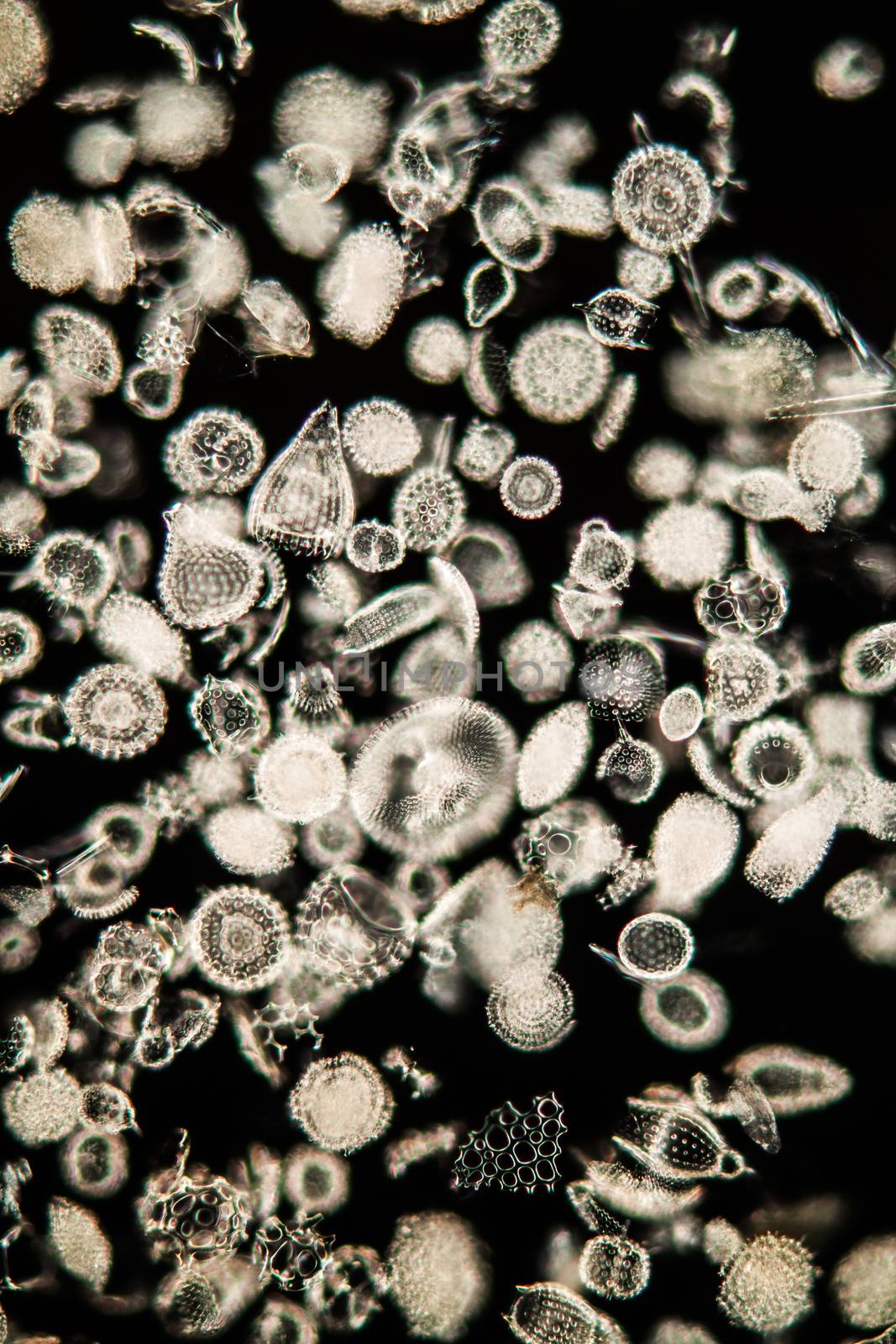 Radiolaria marine animals under the microscope 100x by Dr-Lange