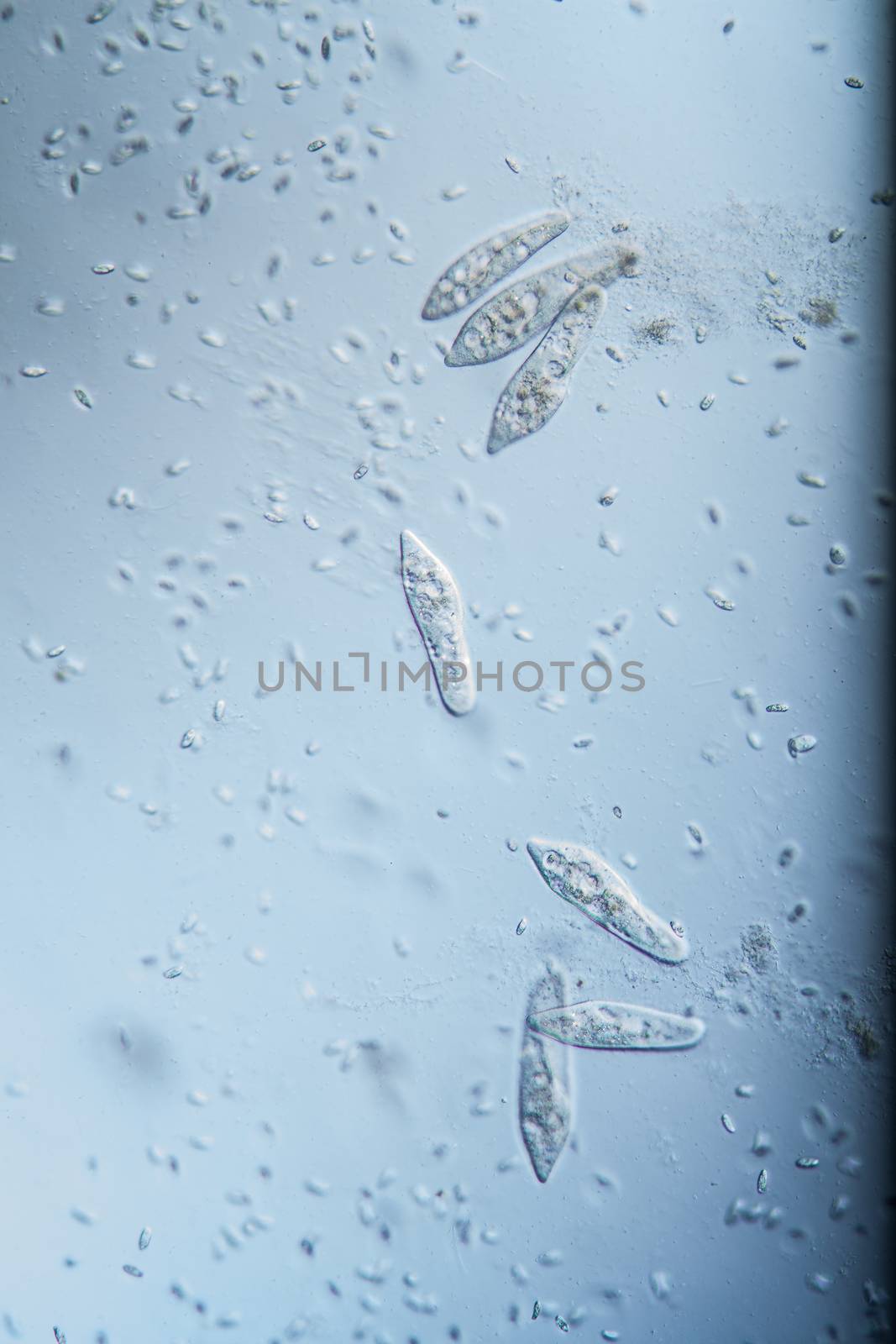 Ciliate plankton unicellular in drops of water 100x by Dr-Lange