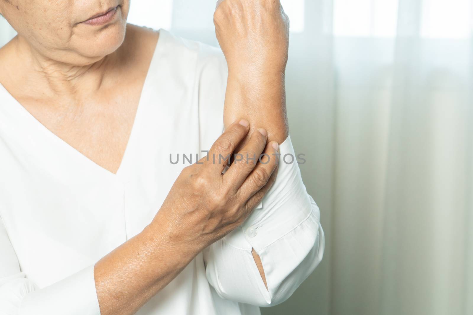 senior women scratch hand the itch on eczema arm, healthcare and medicine concept