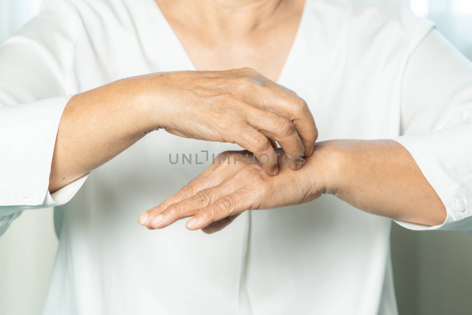 senior women scratch the itch on eczema hand, healthcare and medicine concept