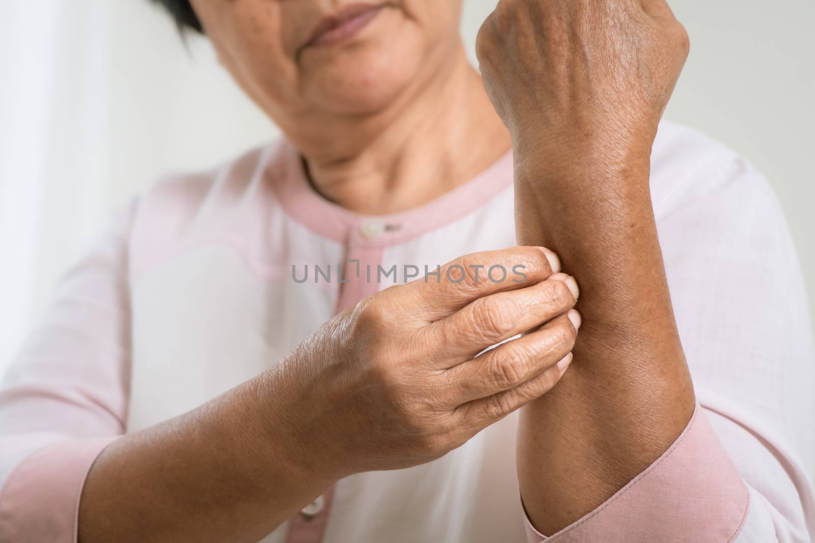 senior women scratch arm the itch on eczema arm, healthcare and medicine concept
