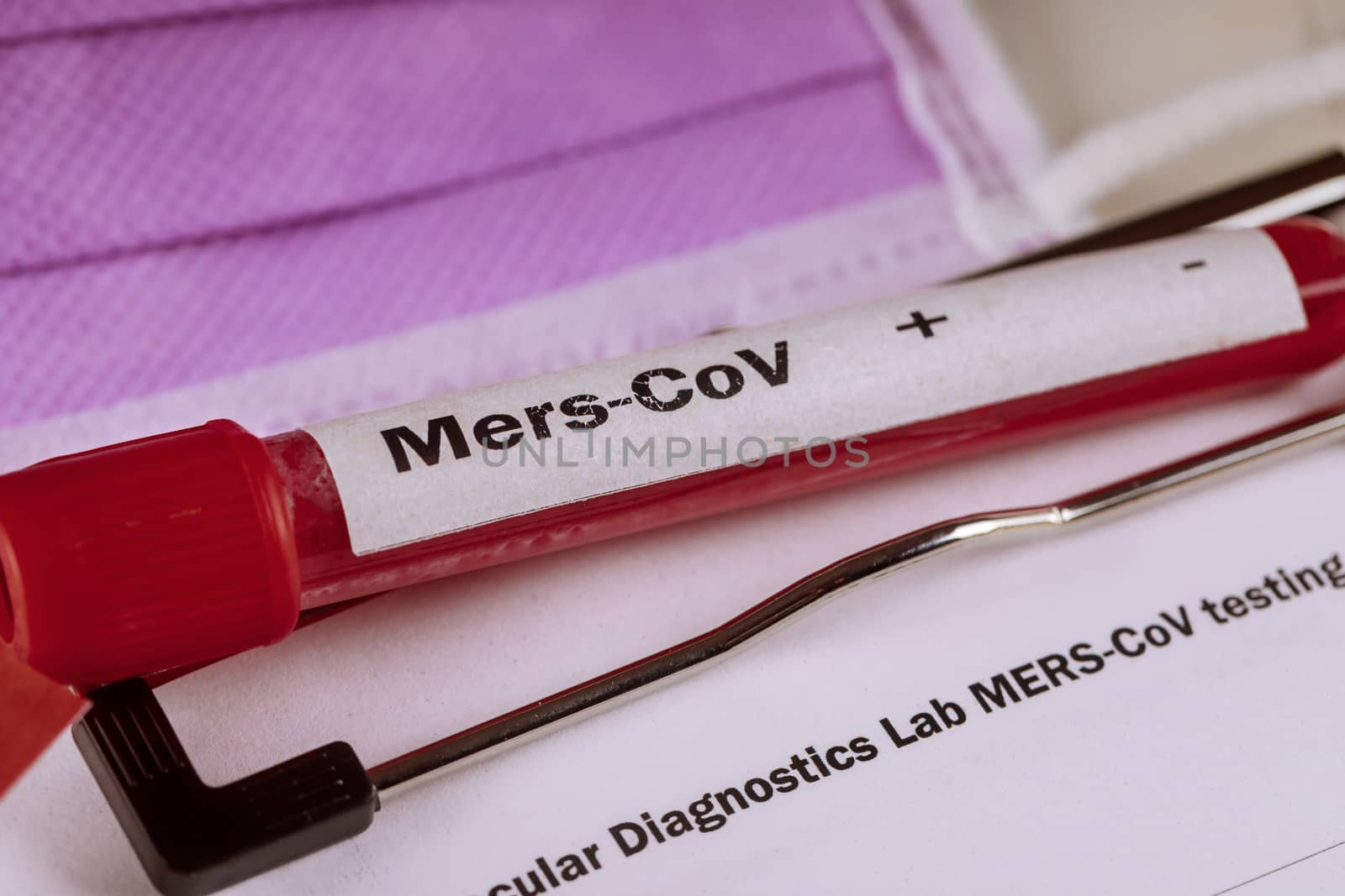 Test tube containing MERS-CoV, medical reseacher in a laboratory by ungvar