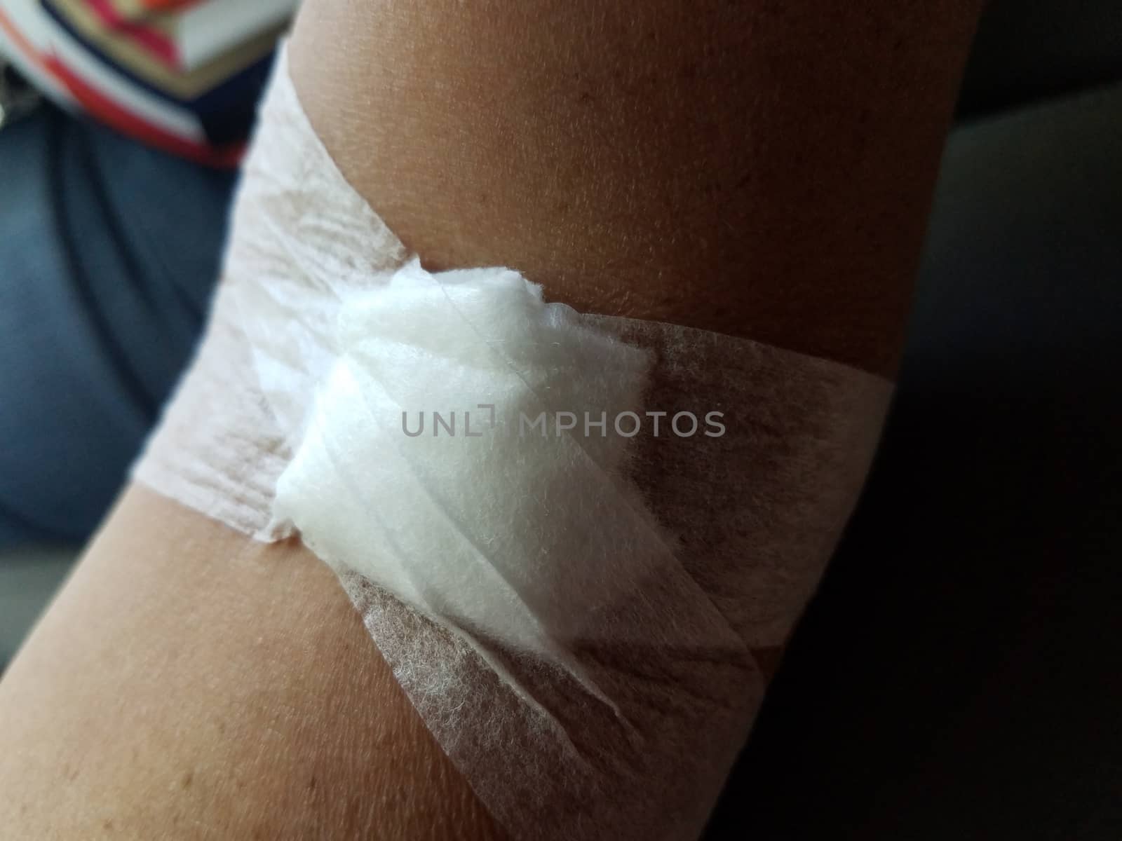 white cotton and bandage dressing on woman or female arm