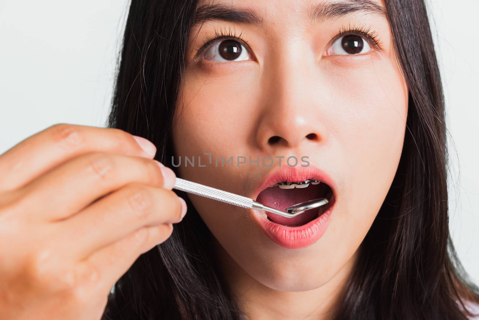 Asian teen beautiful young woman smile have dental braces on teeth laughing and have medical equipment tools for check tooth, isolated on a white background, Medicine and dentistry concept