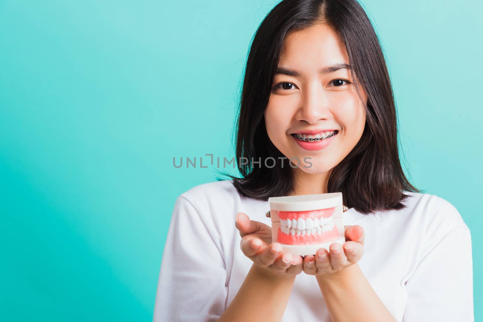 Portrait of Asian teen beautiful young woman smile have dental braces on teeth laughing she holding medical equipment dental model teeth, isolated on a blue background, Medicine and dentistry concept