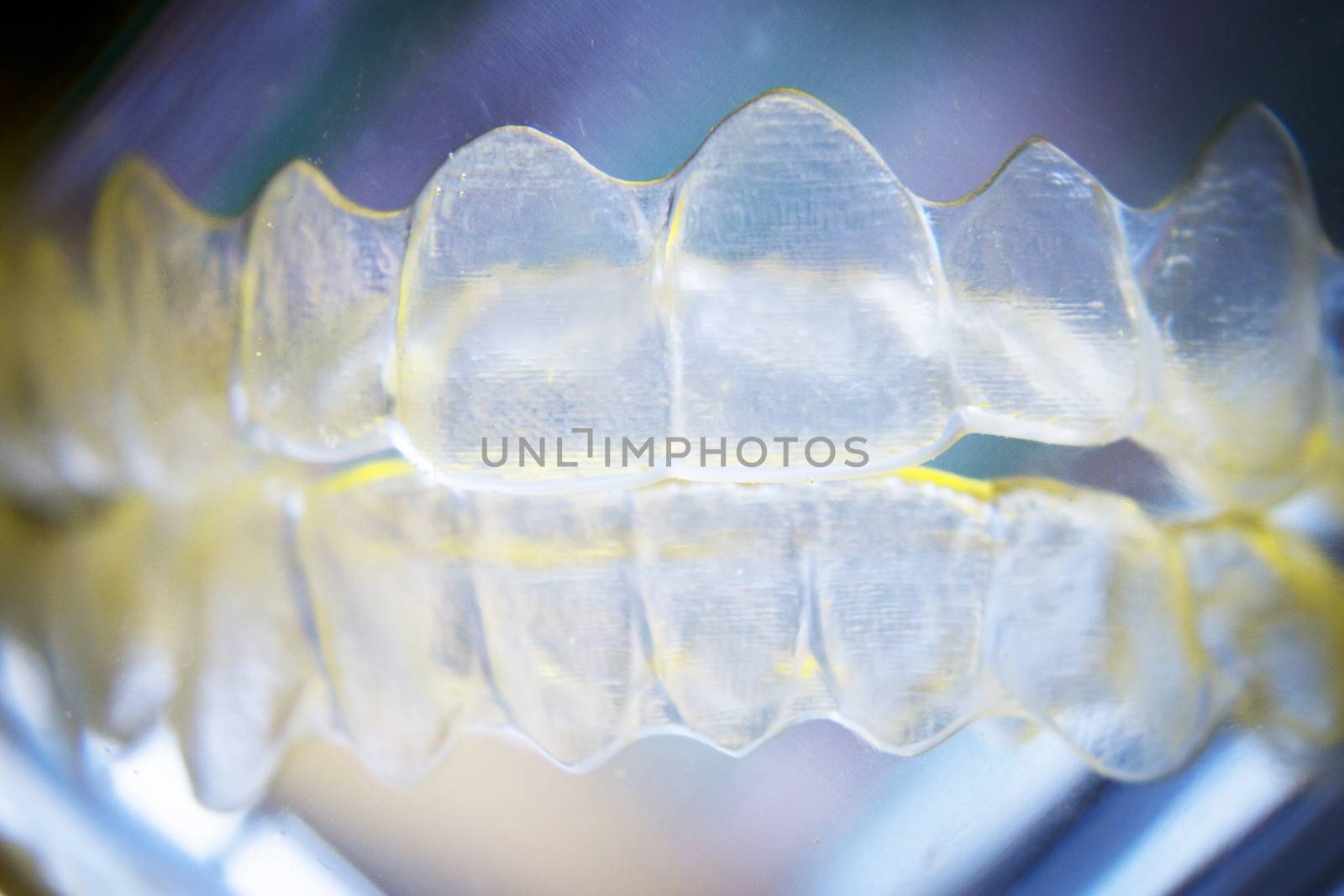 Invisible dental orthodontics lined up cleaning by GemaIbarra