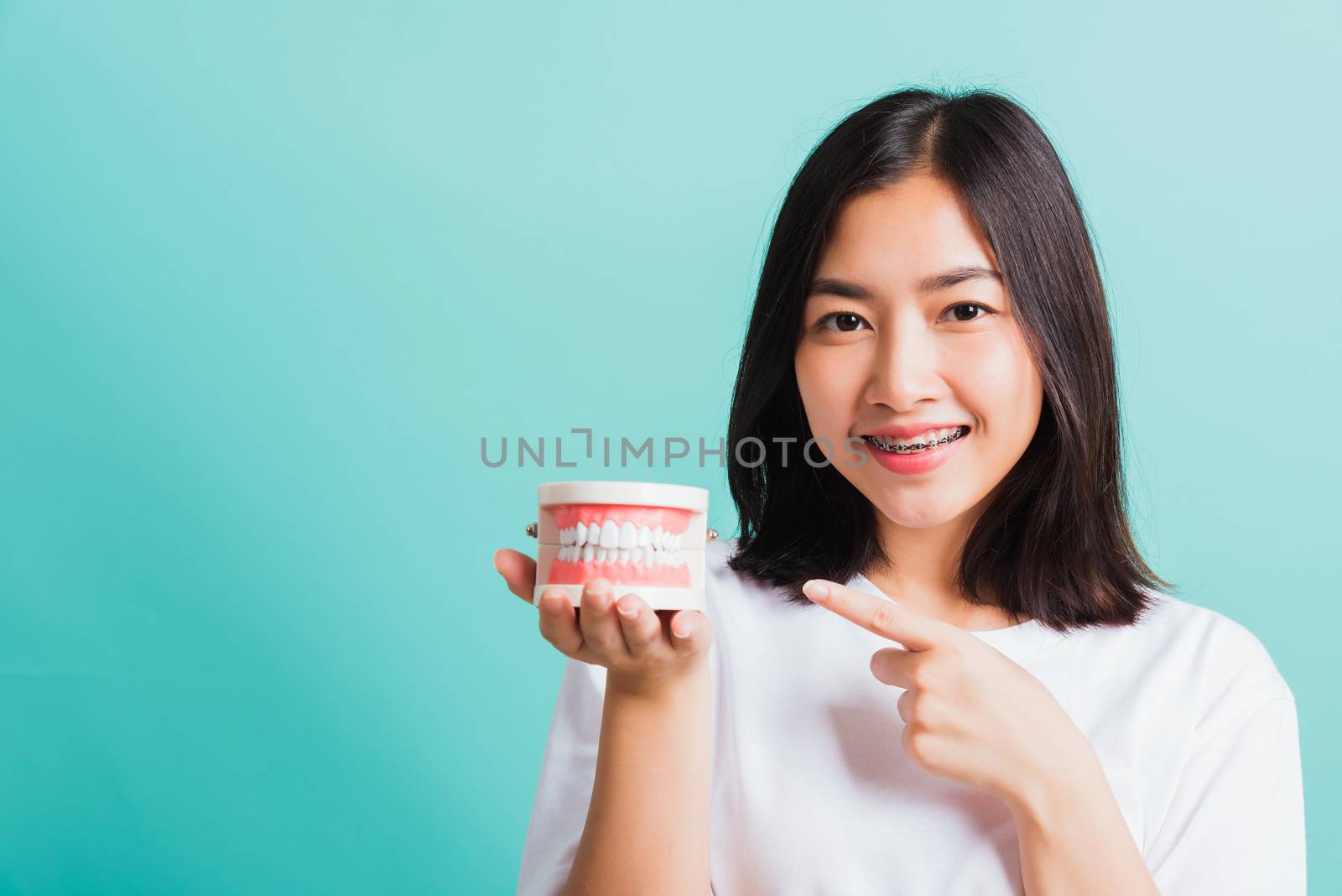 Portrait of Asian teen beautiful young woman smile have dental braces on teeth laughing she pointing medical equipment dental model teeth, isolated on a blue background, Medicine and dentistry concept