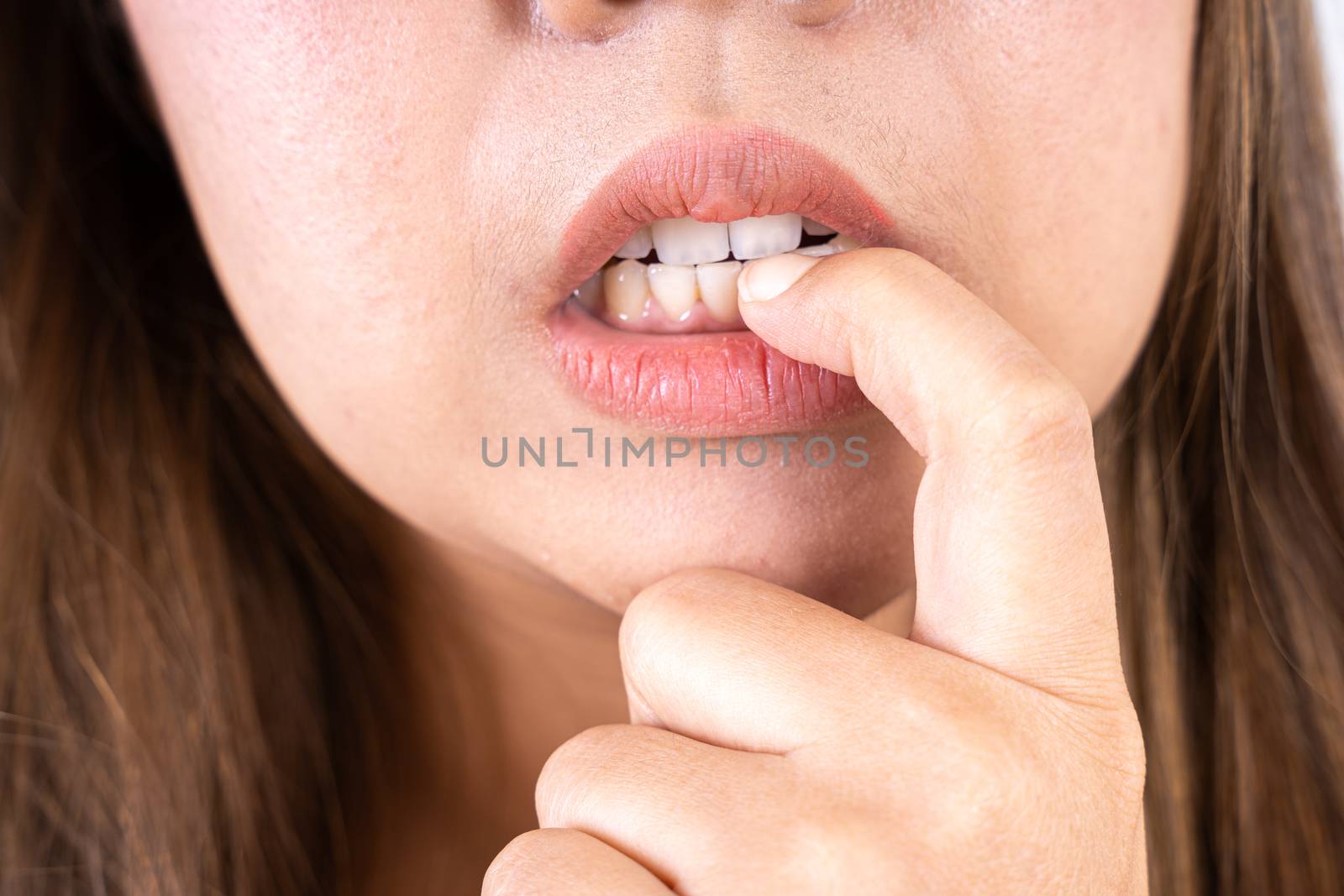 close up nervous woman biting her nails, stressful woman gnawing her nails.