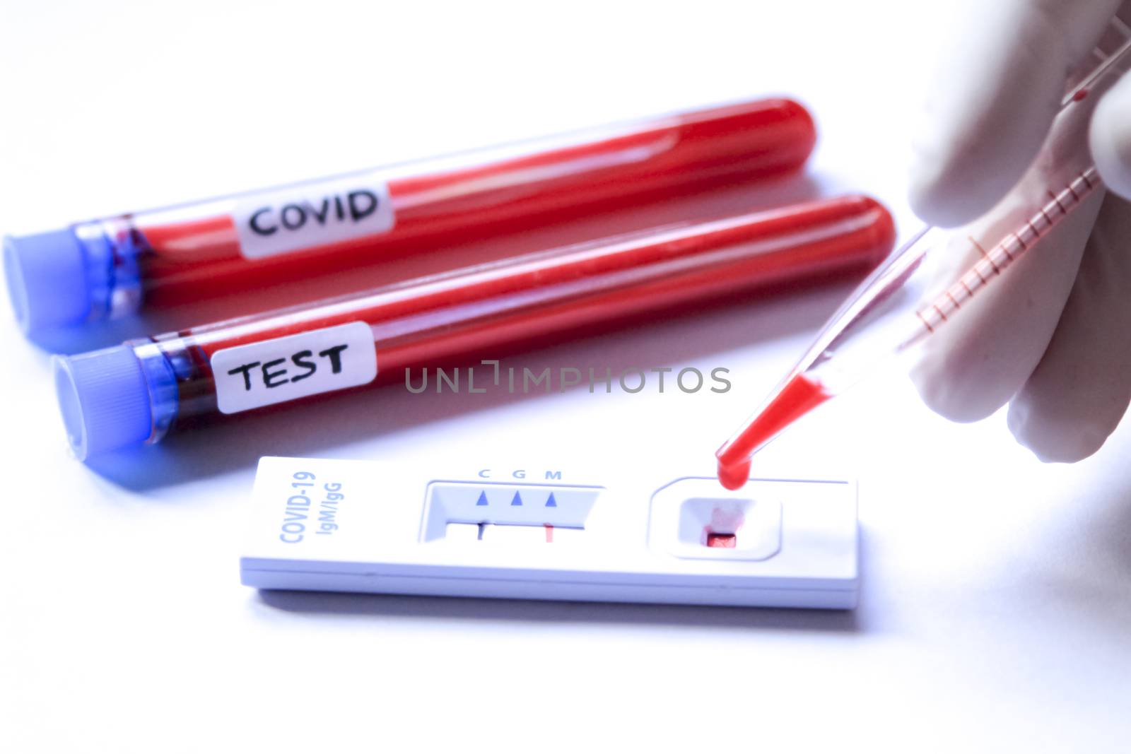 Medical worker placing blood sample on Rapid Diagnostic Test identifying antibodies for Coronavirus SARS-CoV-2 COVID-19
