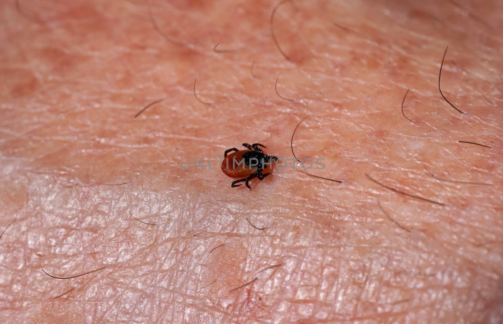 Small tick Ixodes ricinus crawling on human skin by Ivanko