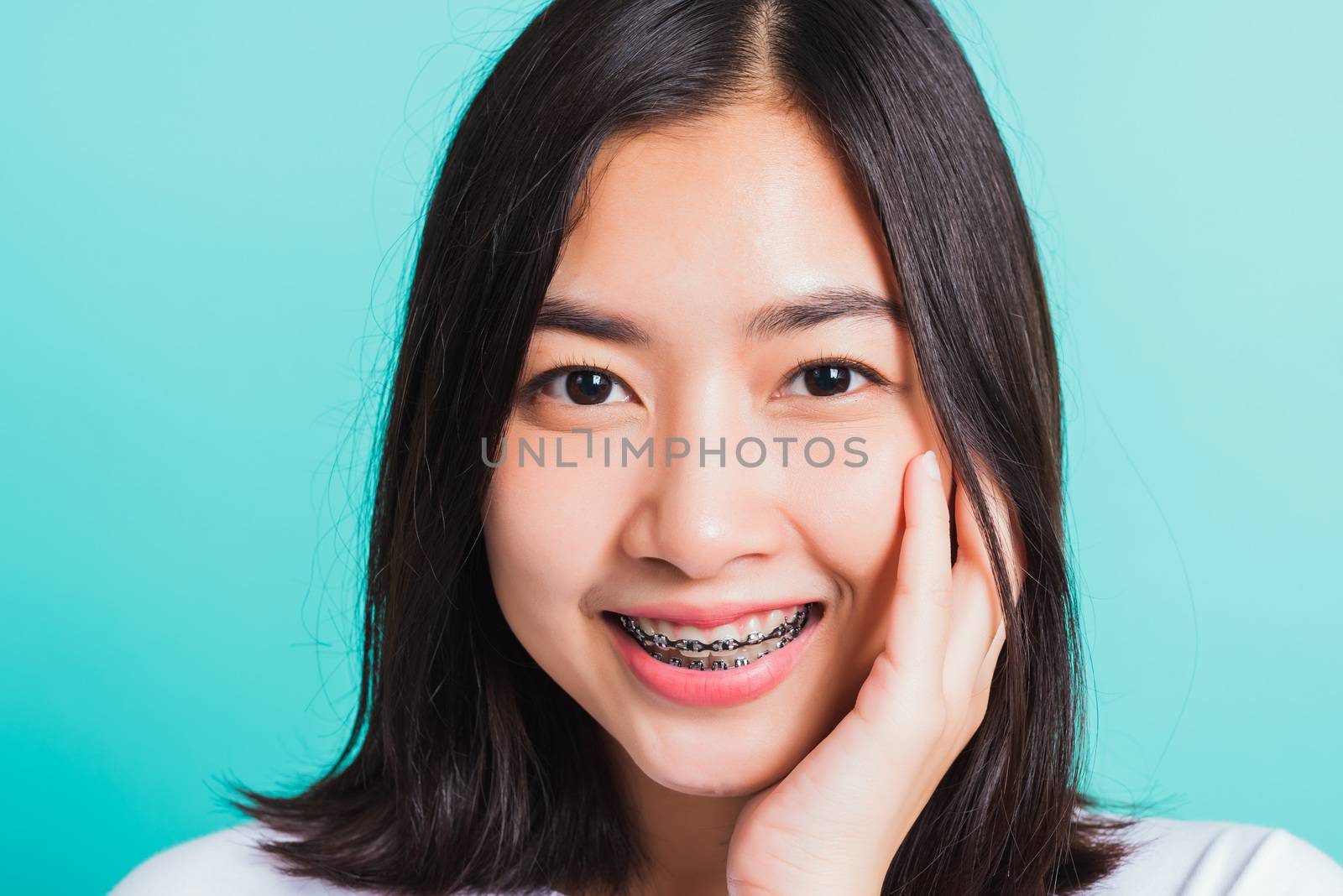 Portrait of Asian teen beautiful young woman smile have dental braces on teeth laughing she touching her face by hand, studio shot isolated on a blue background, Medicine and dentistry concept